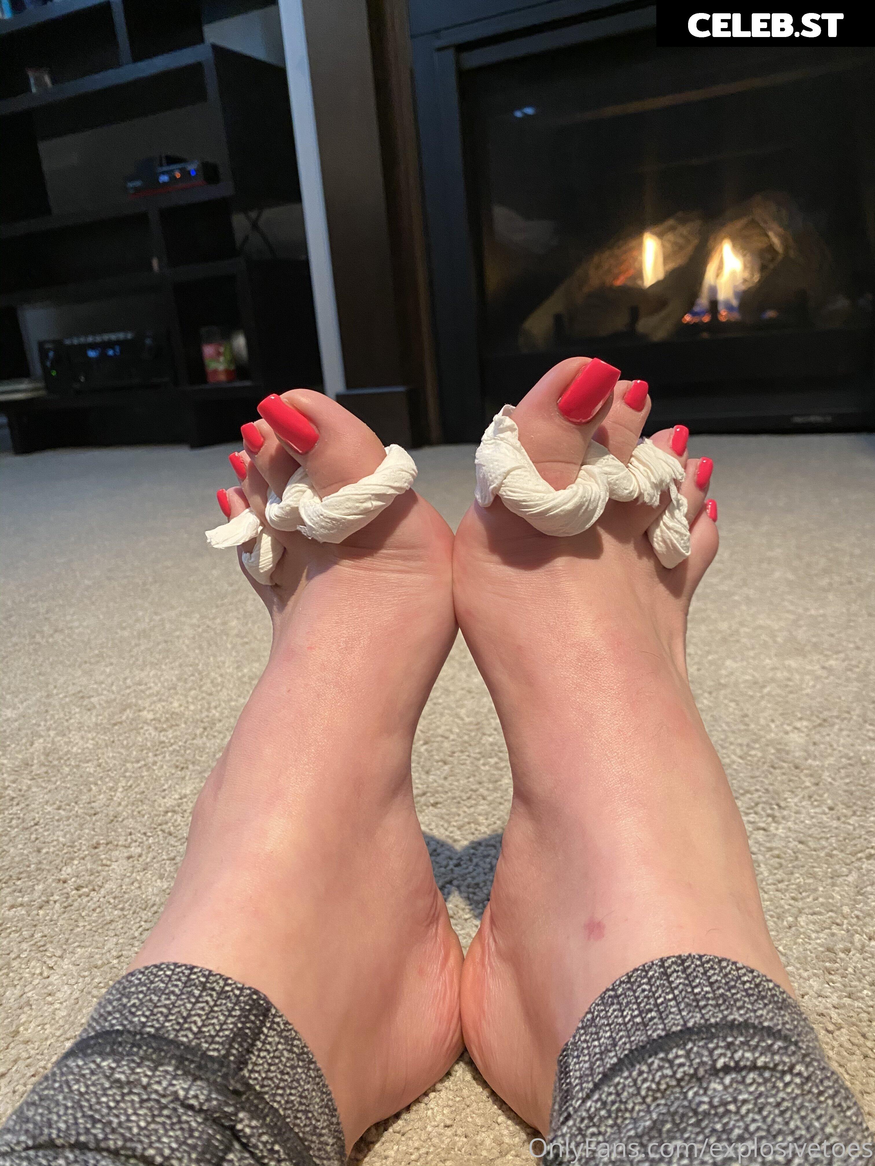 explosivetoess Image 17768212