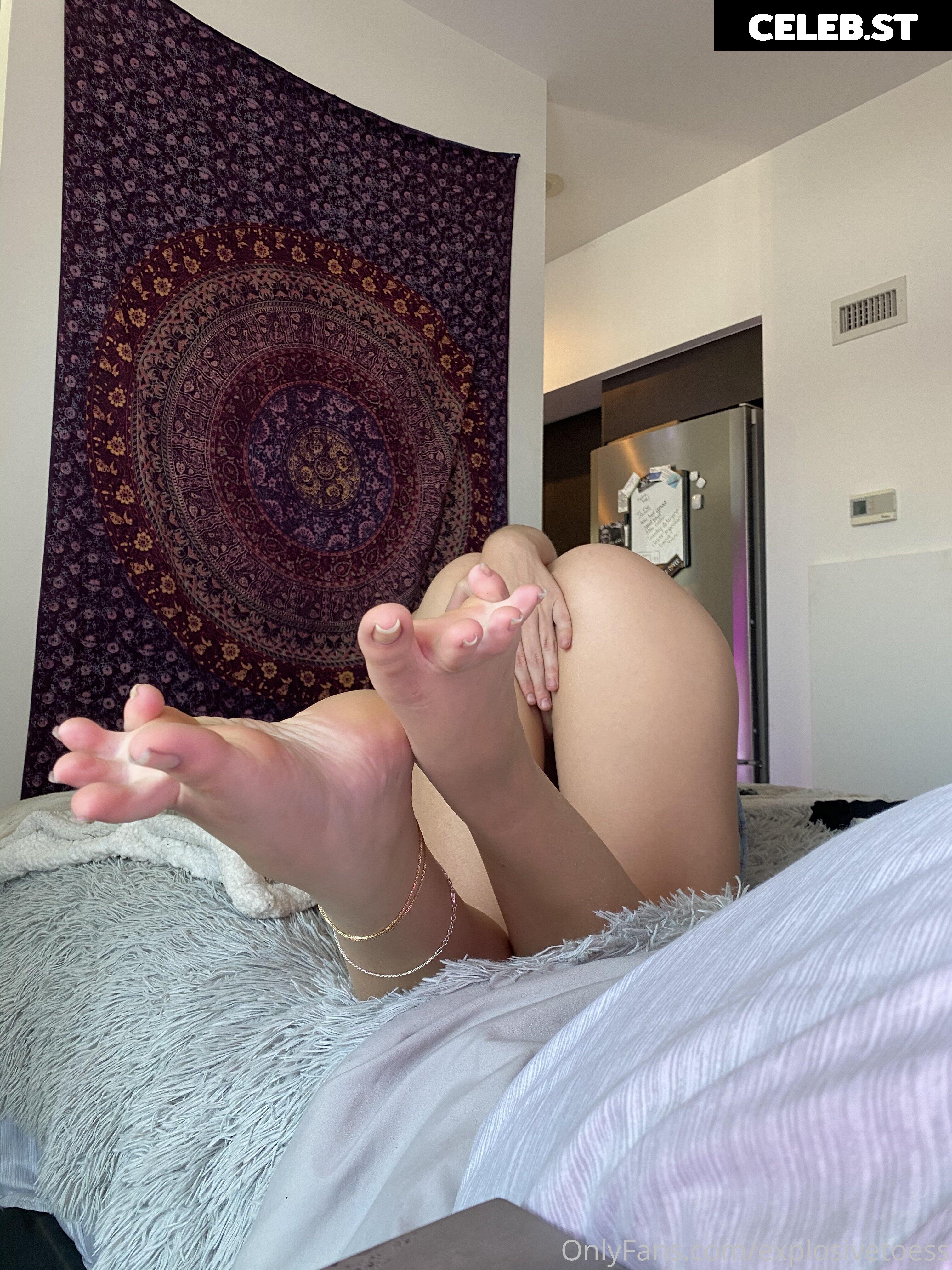 explosivetoess Image 17765965