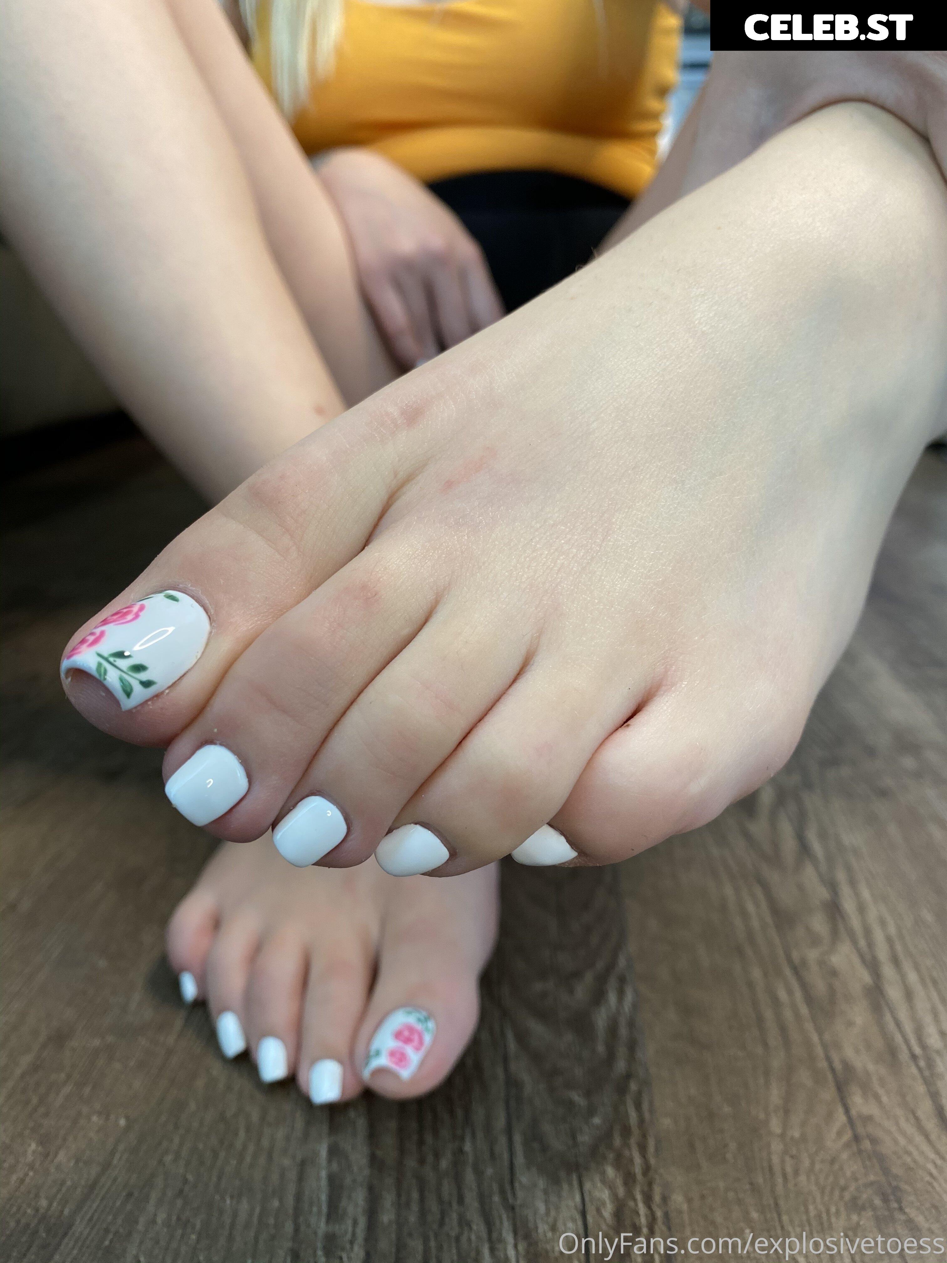 explosivetoess Image 17764489