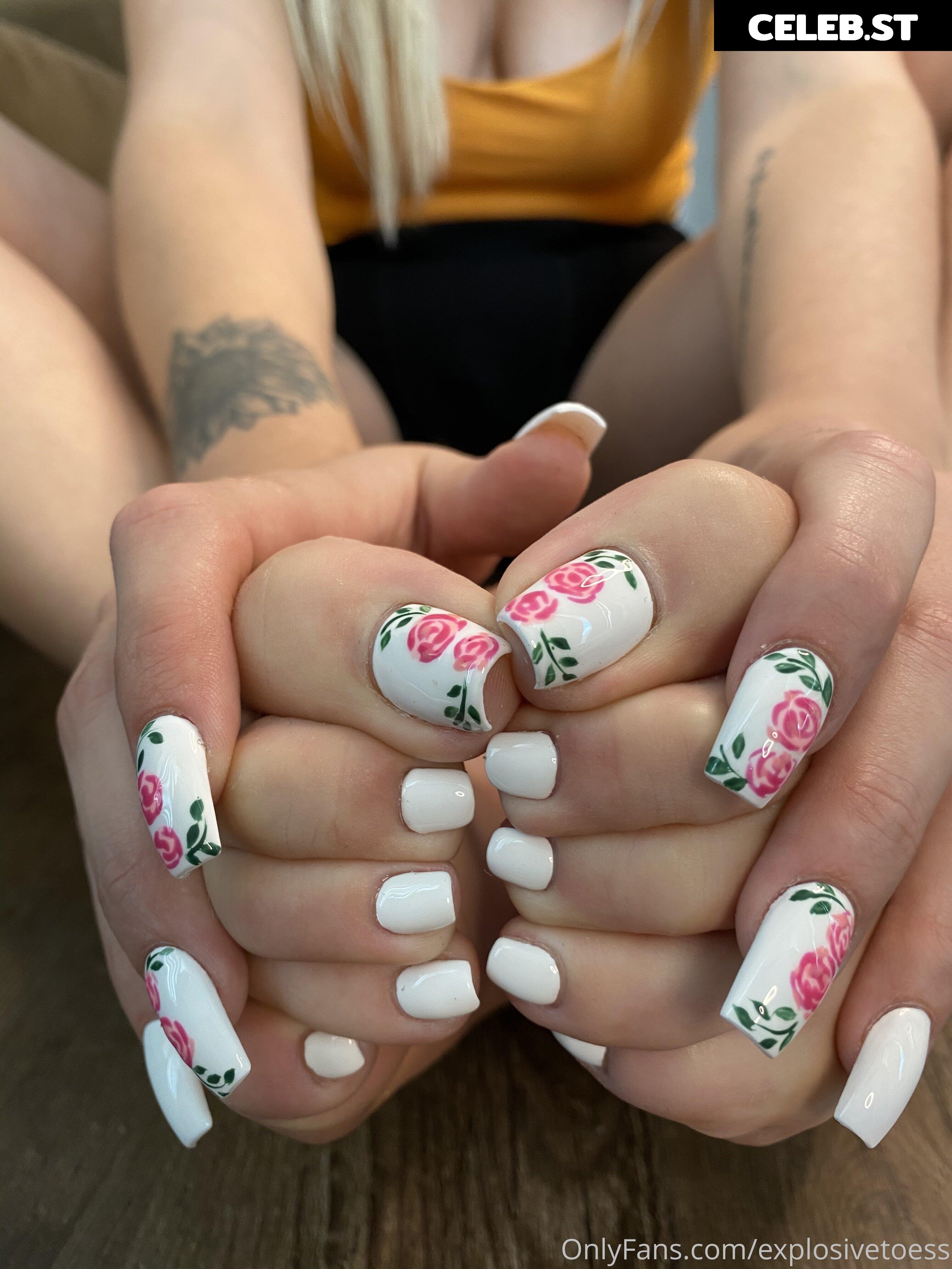 explosivetoess Image 17764783