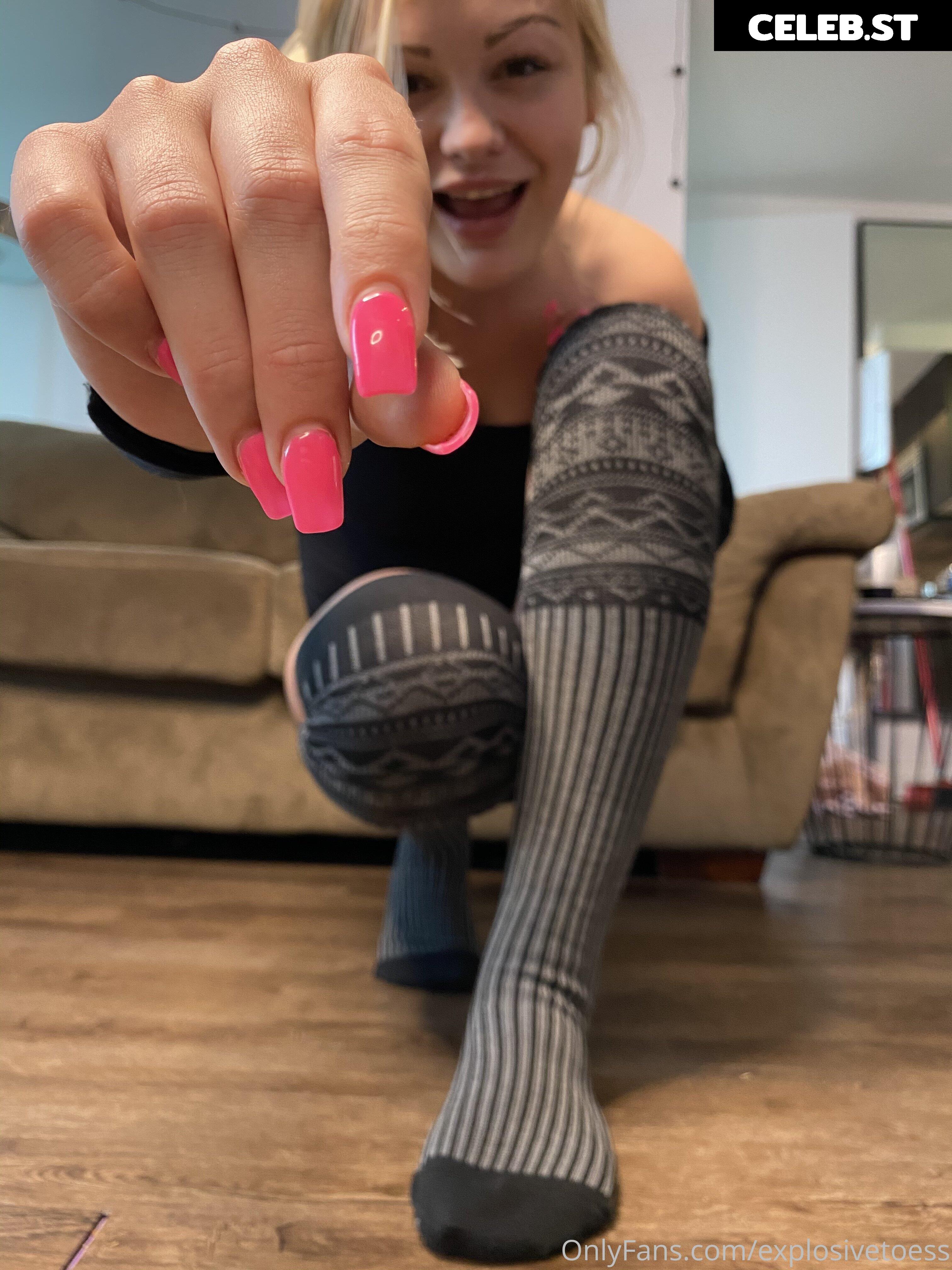explosivetoess Image 17764741