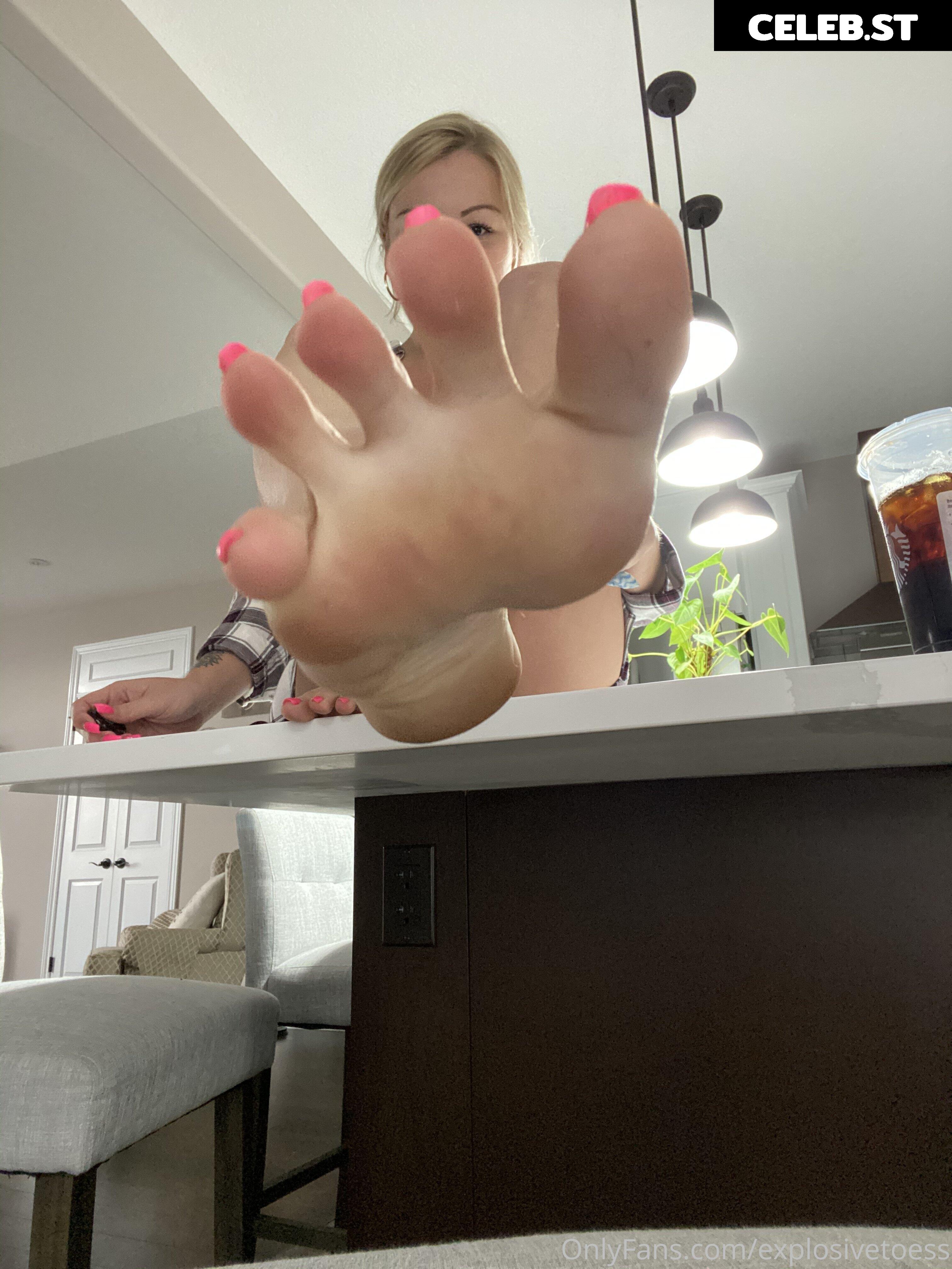 explosivetoess Image 17764628
