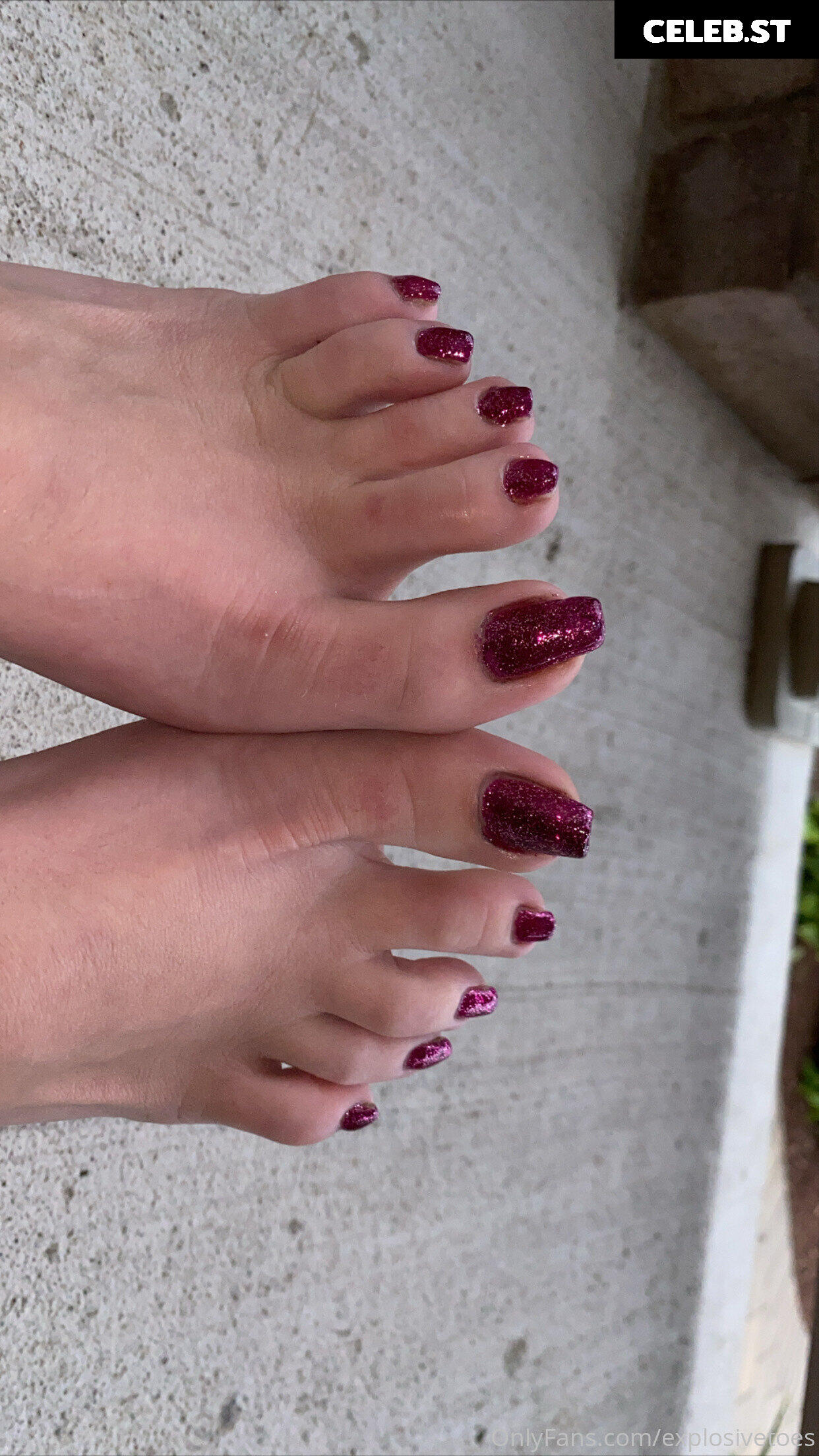 explosivetoess Image 17767529