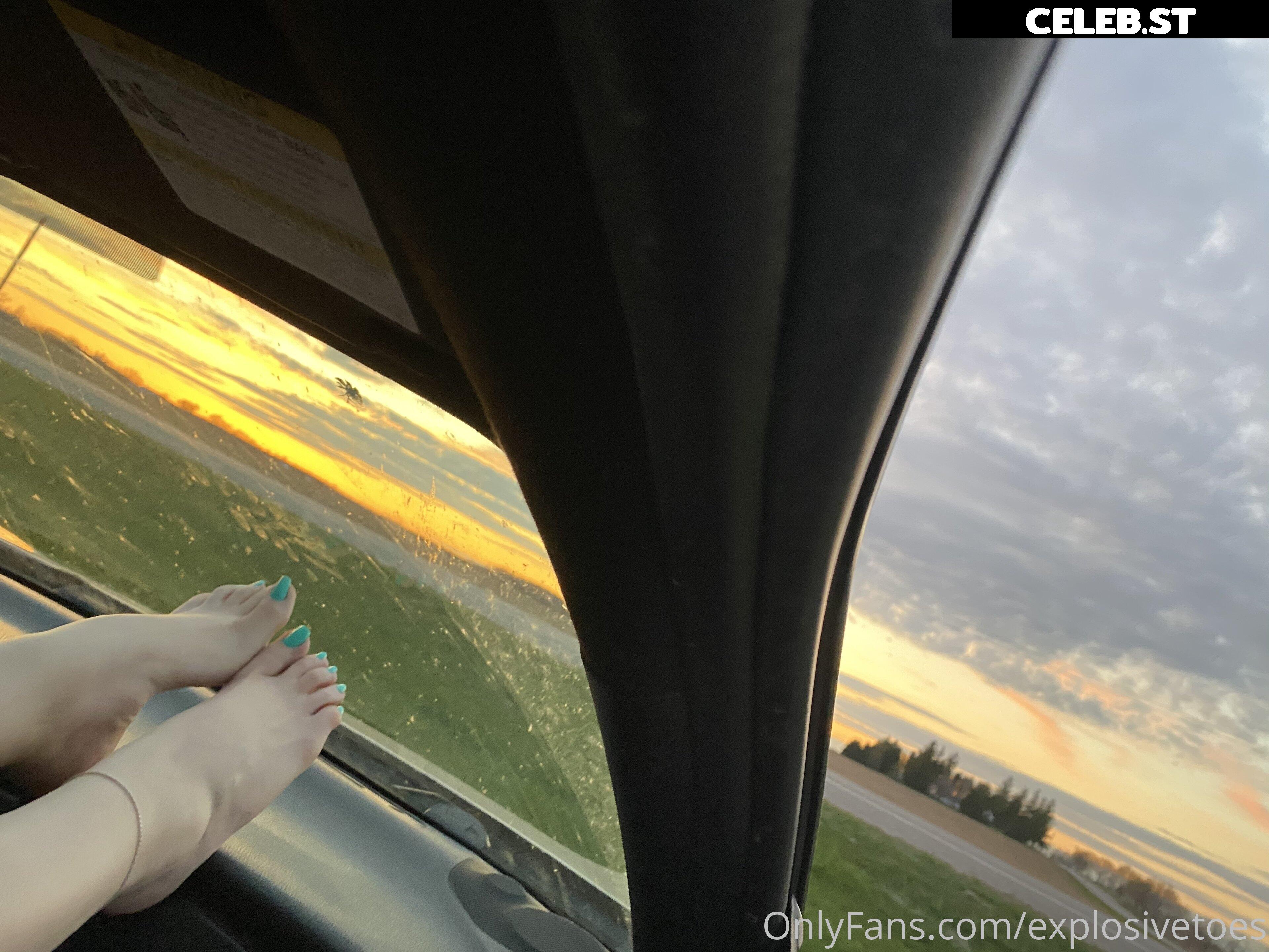 explosivetoess Image 17767444