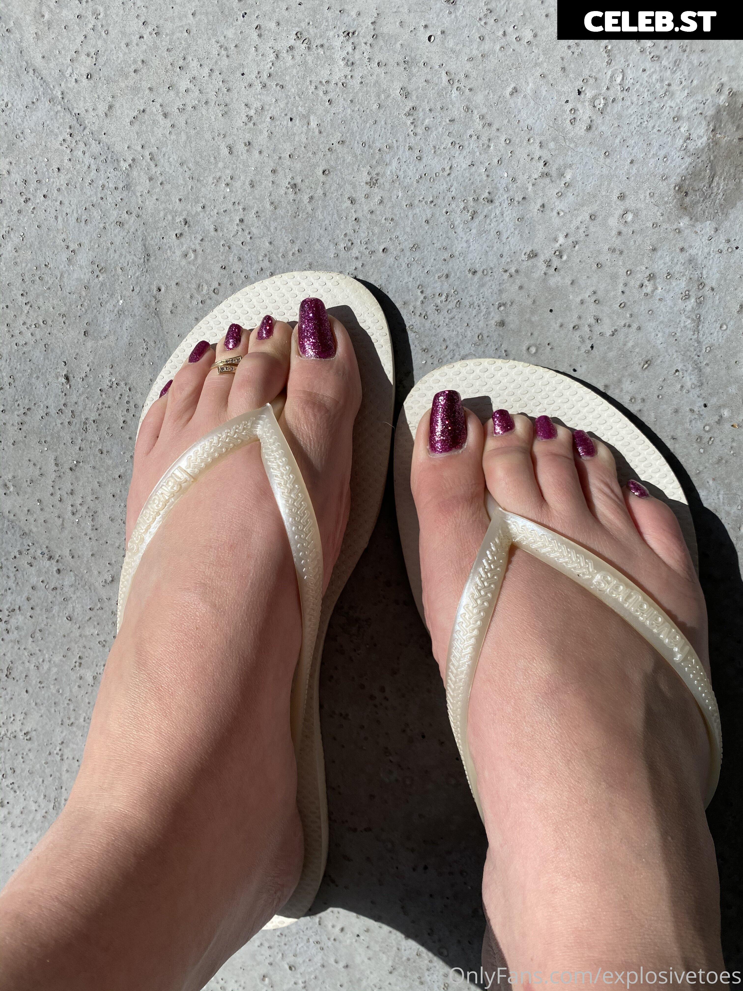 explosivetoess Image 17767020