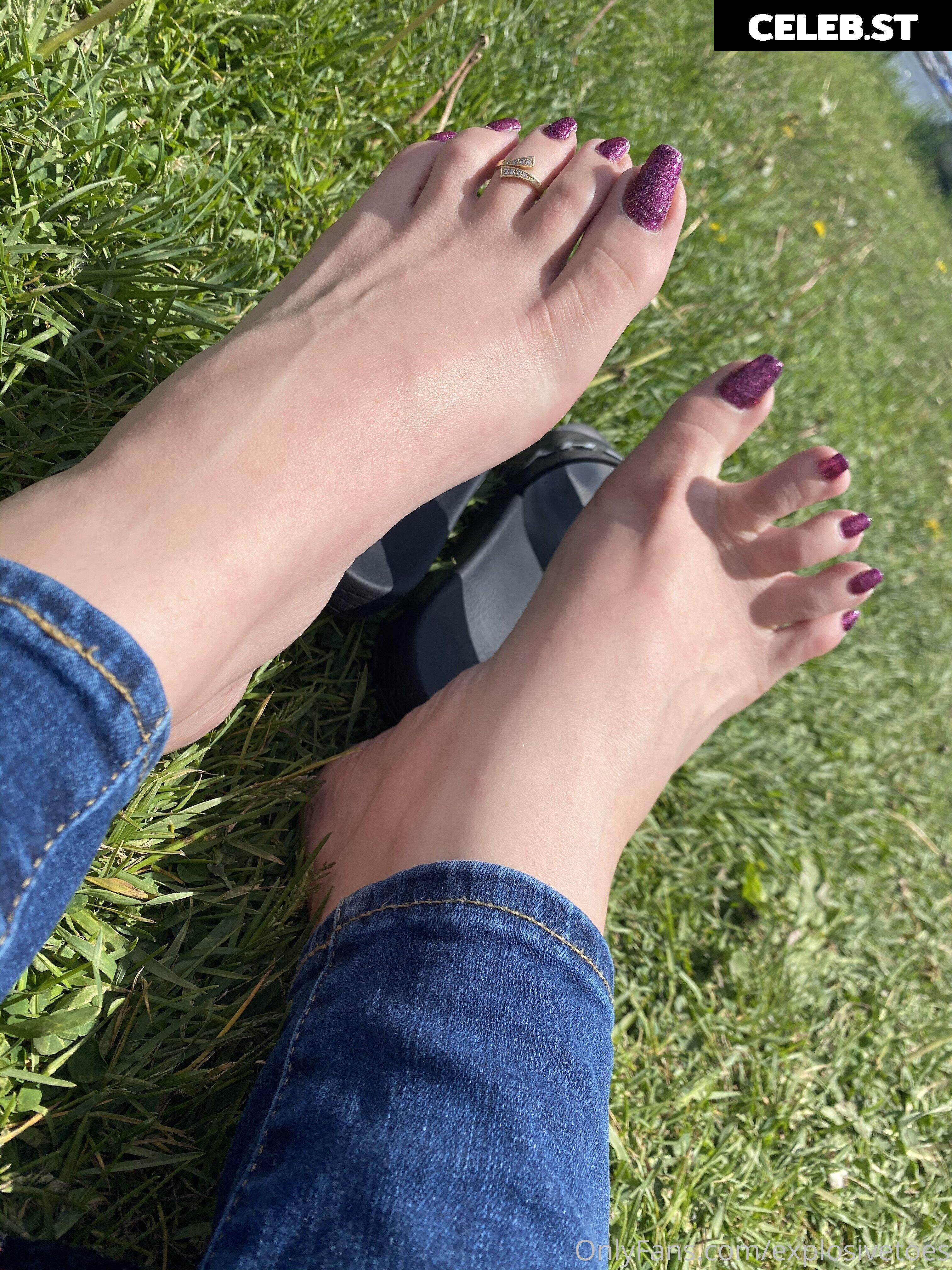 explosivetoess Image 17767028