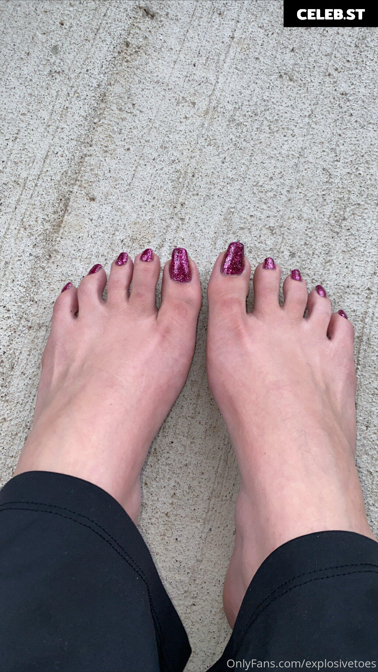 explosivetoess Image 17767072