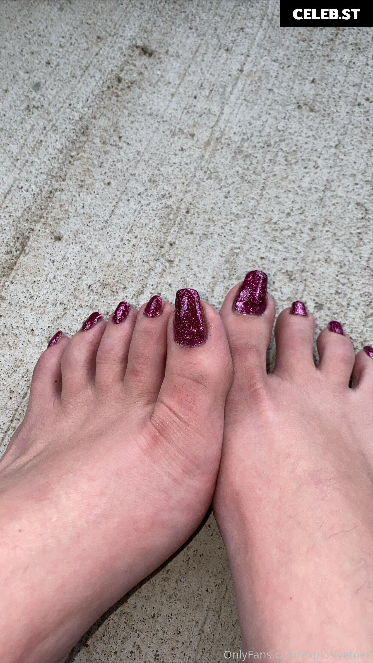 explosivetoess Image 17767300
