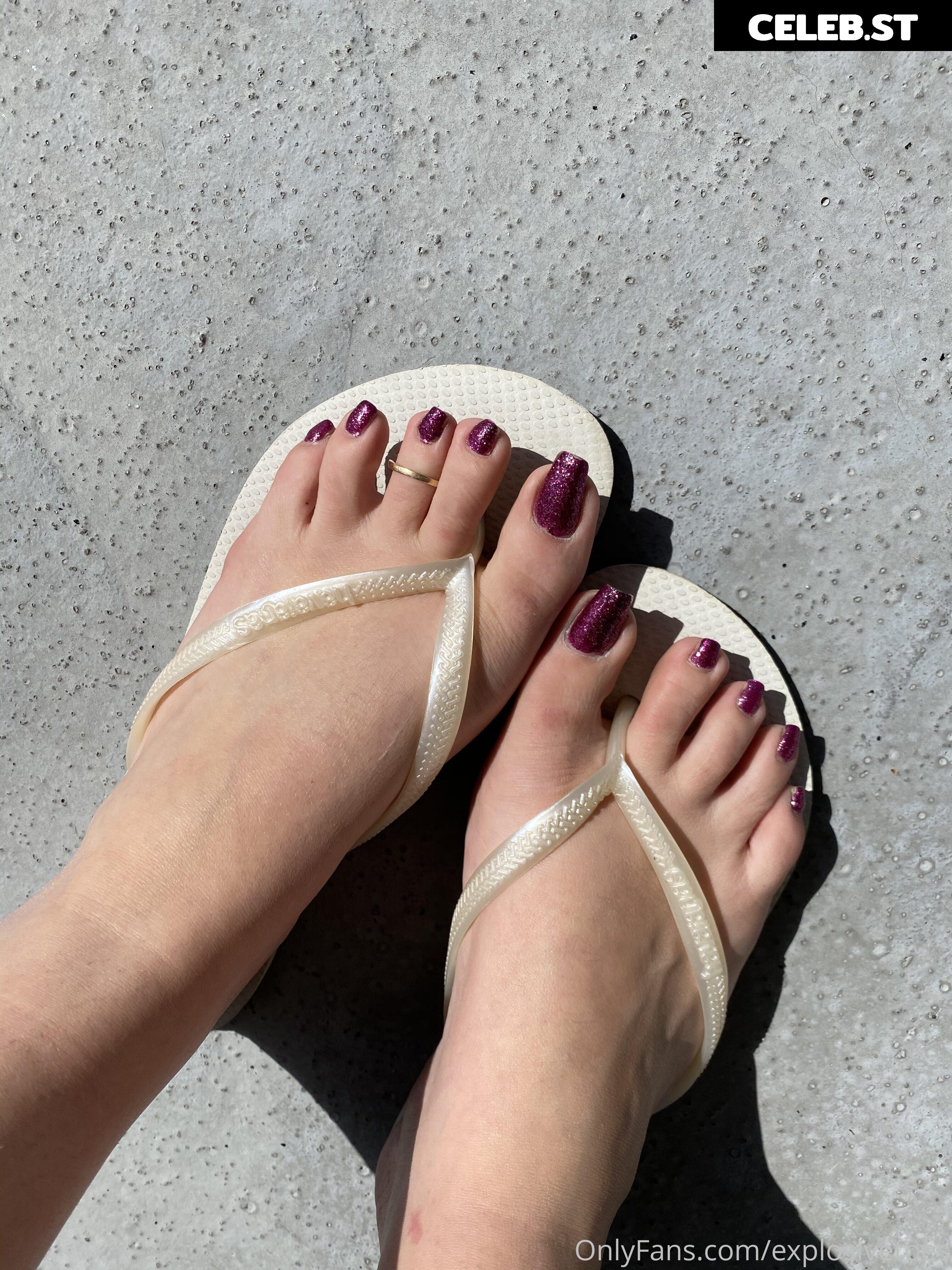 explosivetoess Image 17767349