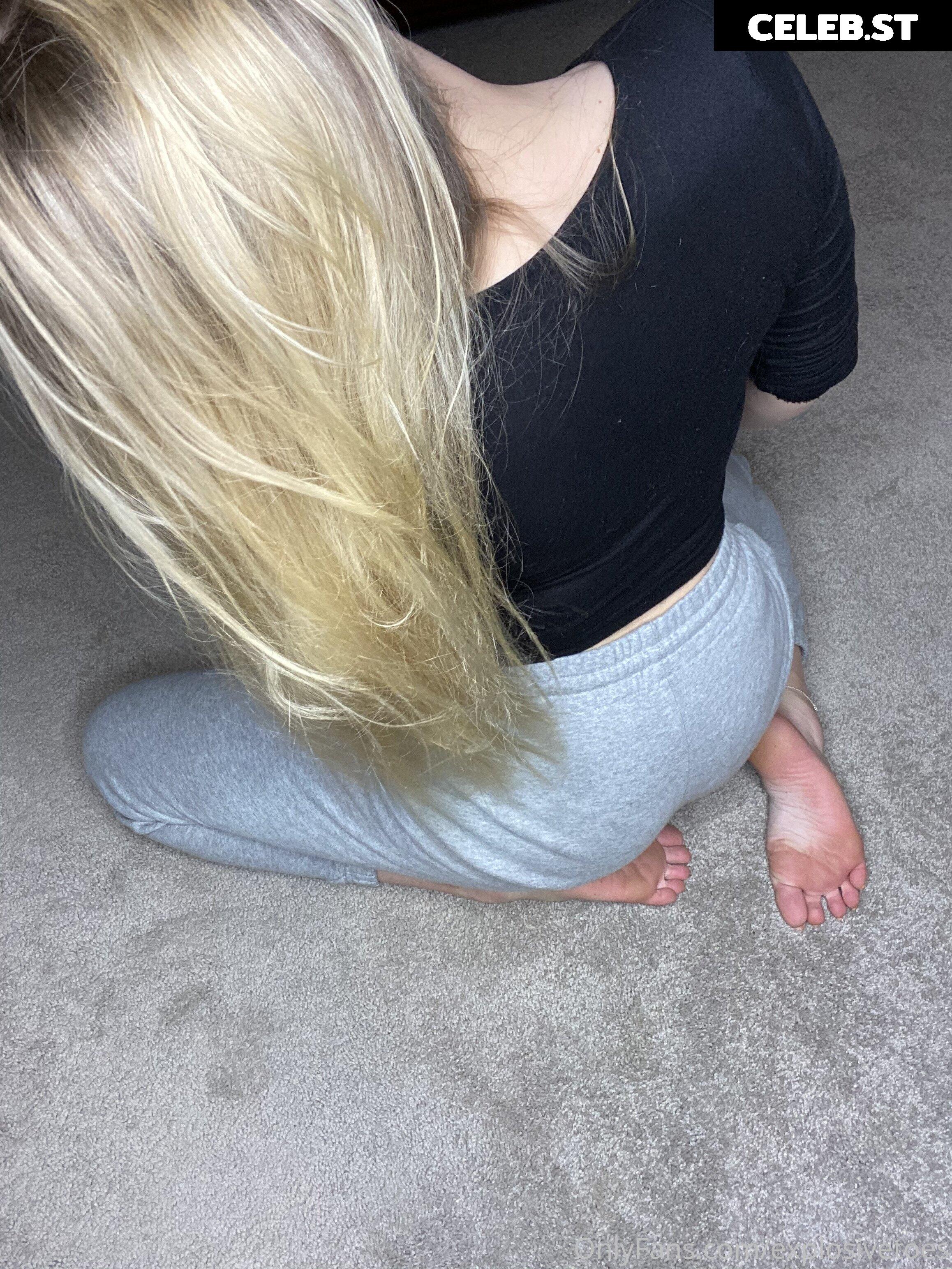 explosivetoess Image 17767379