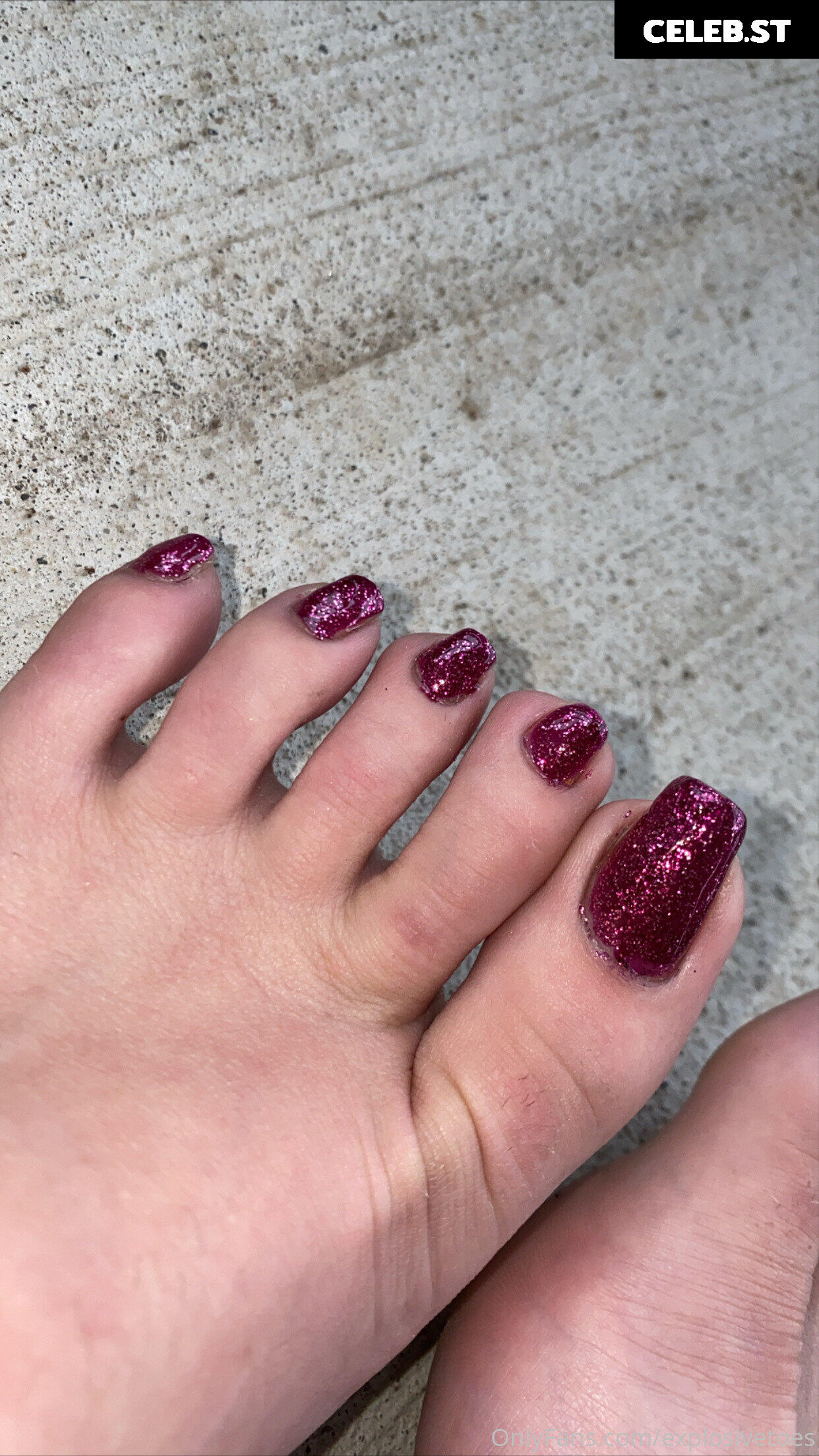 explosivetoess Image 17767290