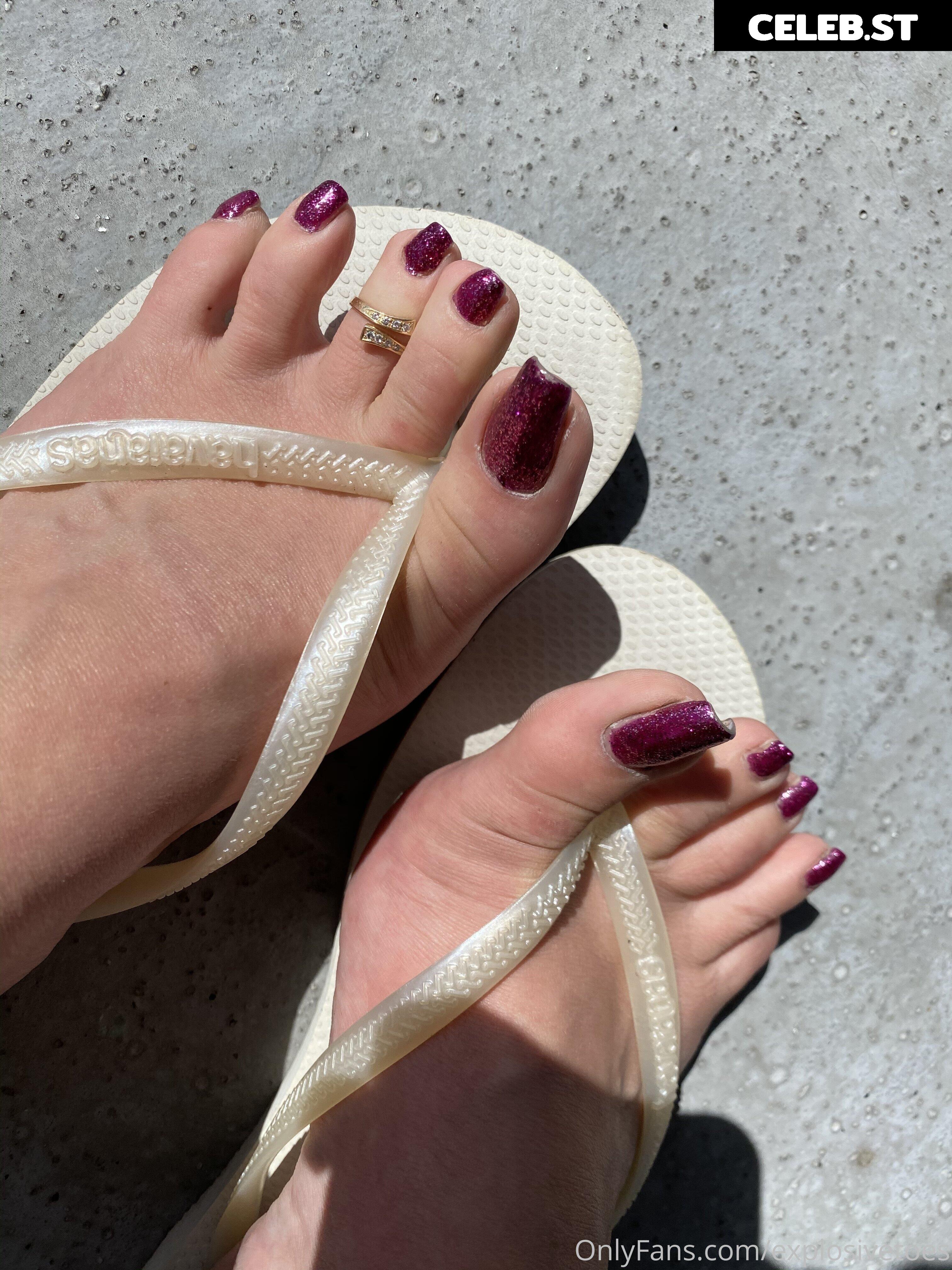 explosivetoess Image 17767285