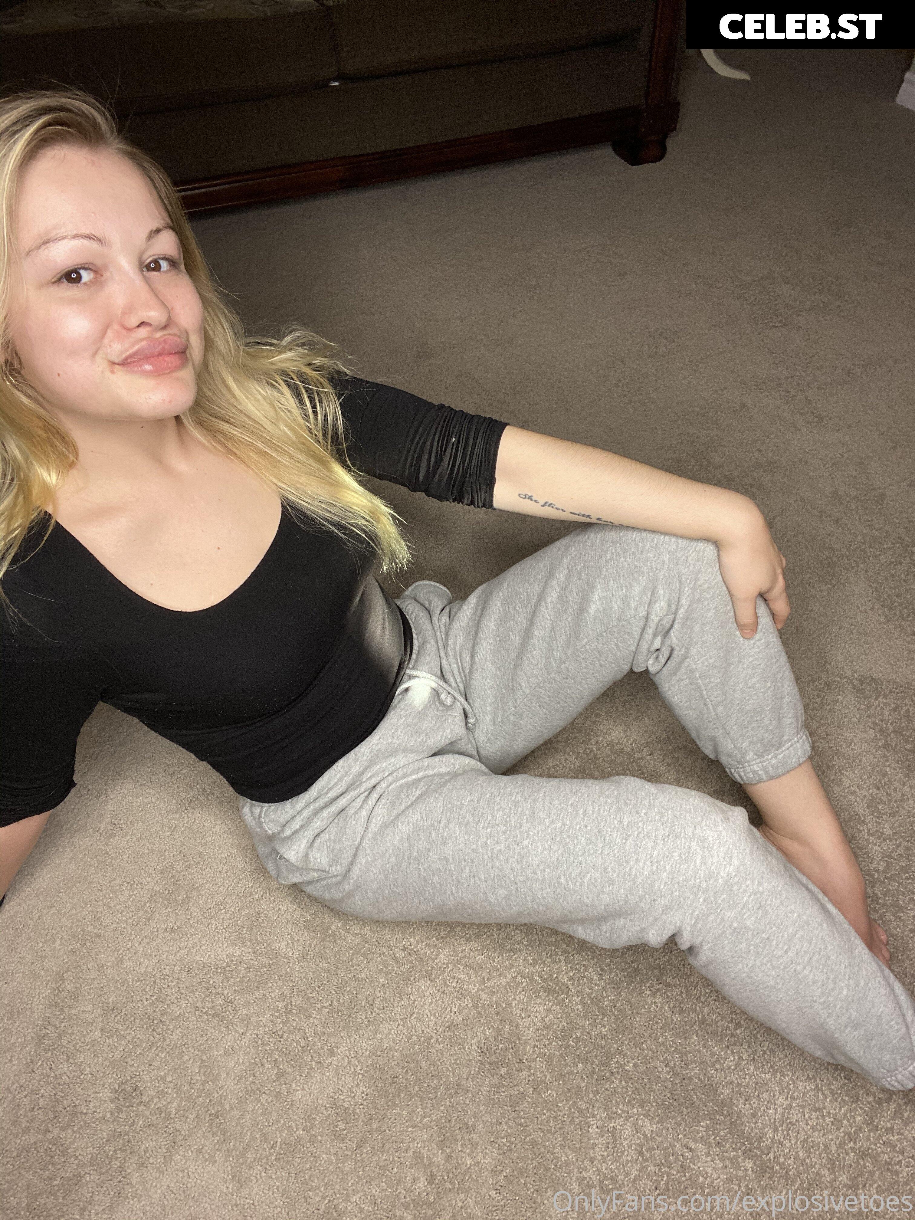 explosivetoess Image 17767260