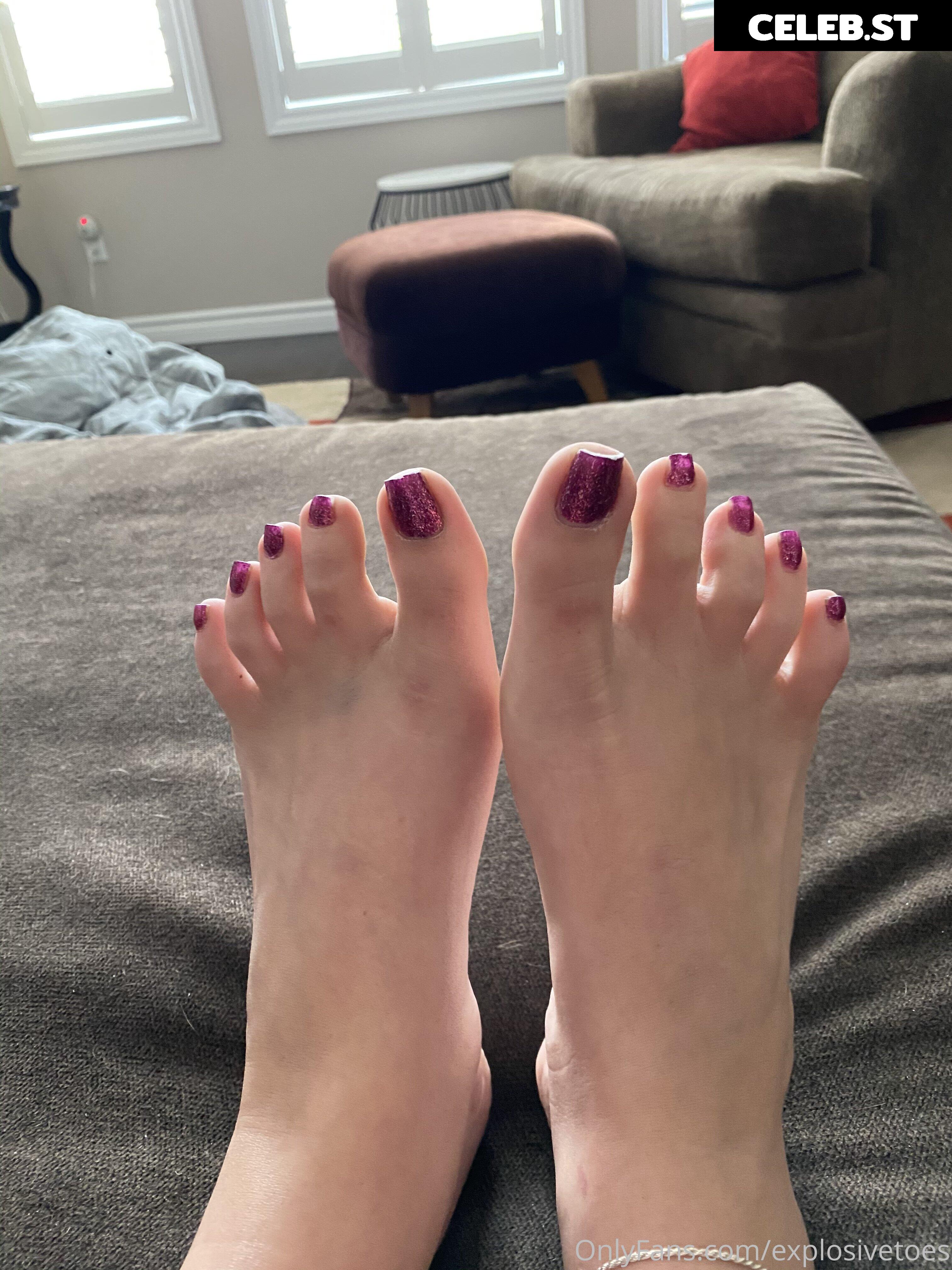 explosivetoess Image 17766973