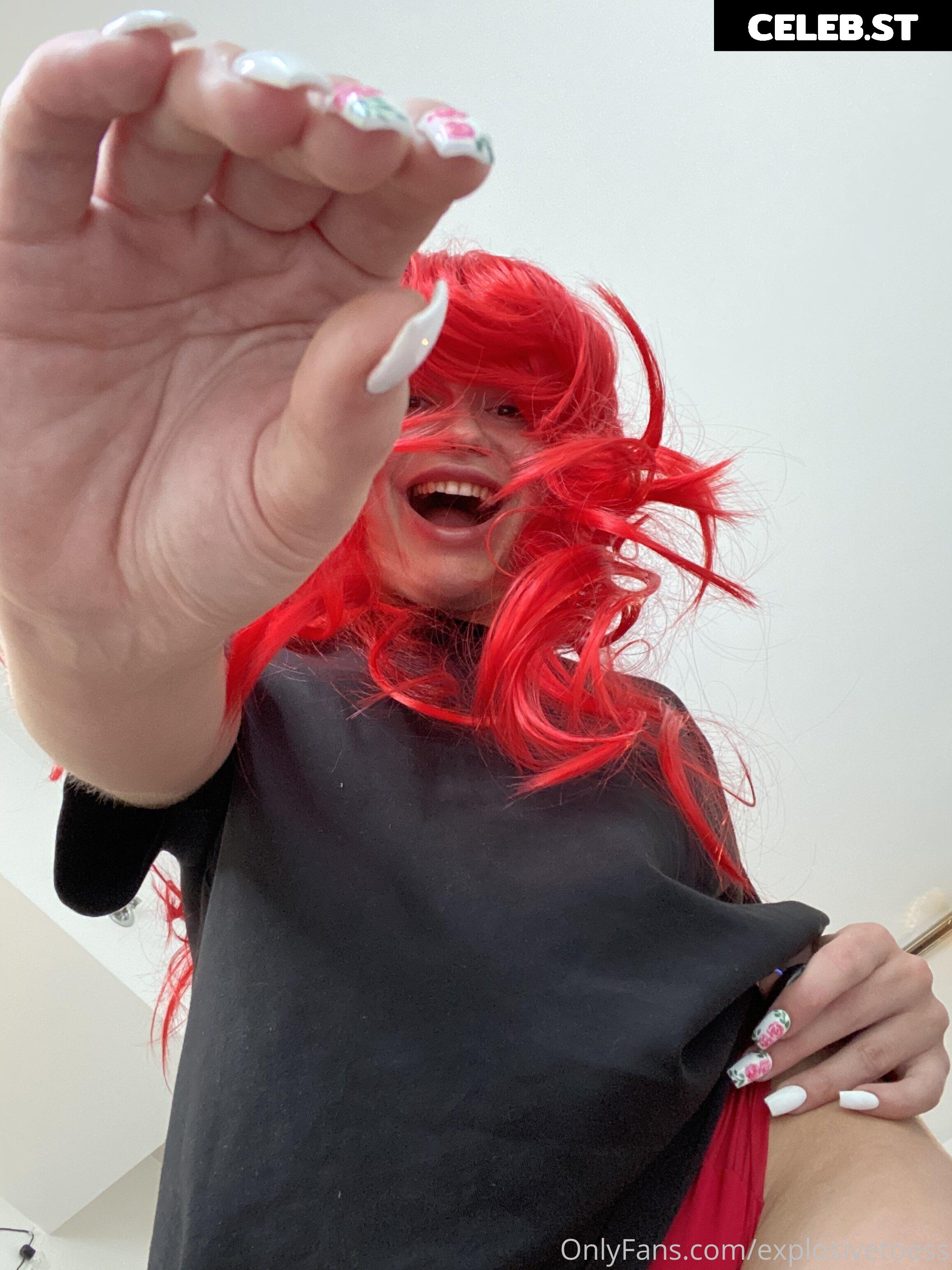 explosivetoess Image 17763087