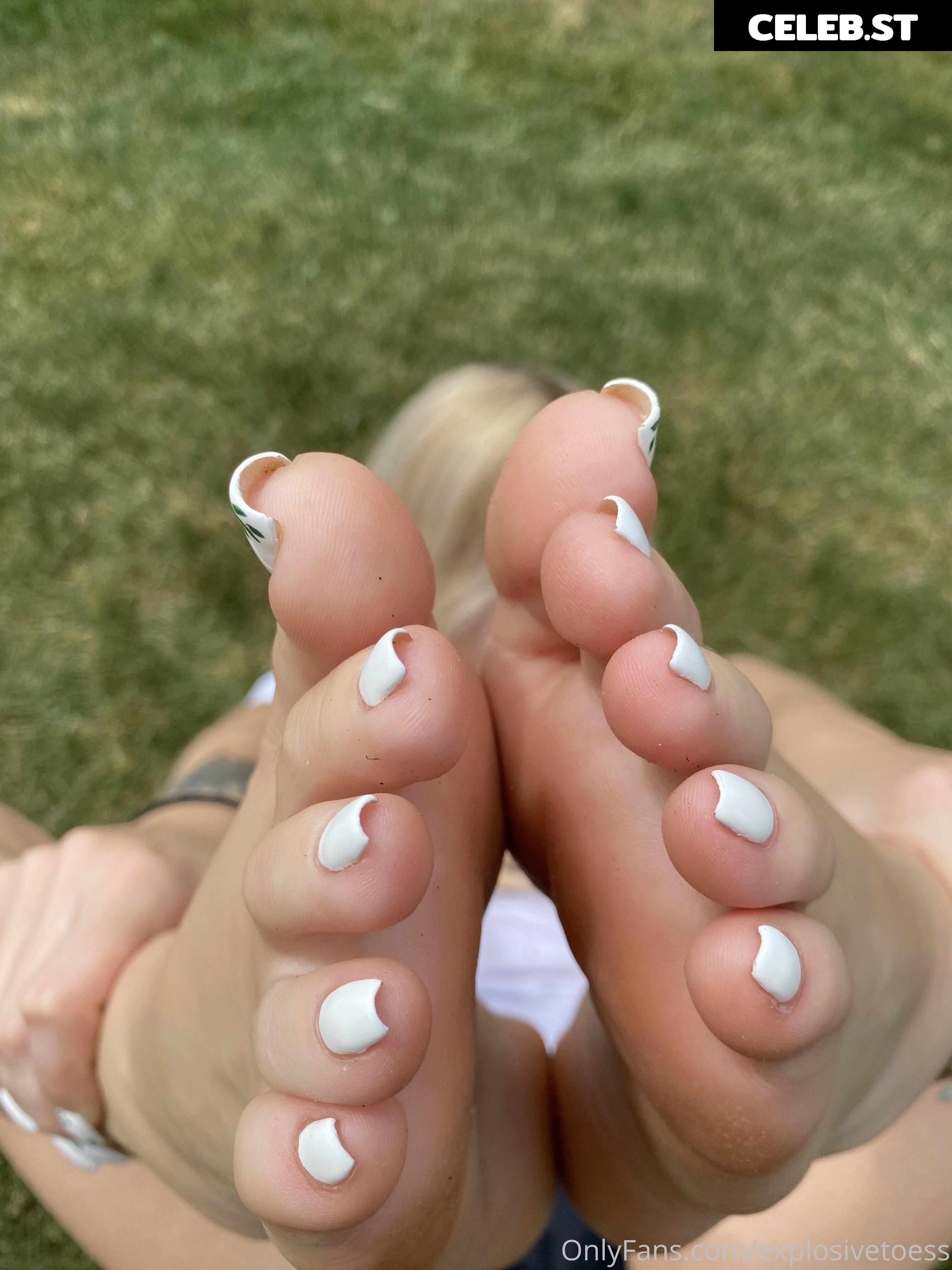 explosivetoess Image 17762802