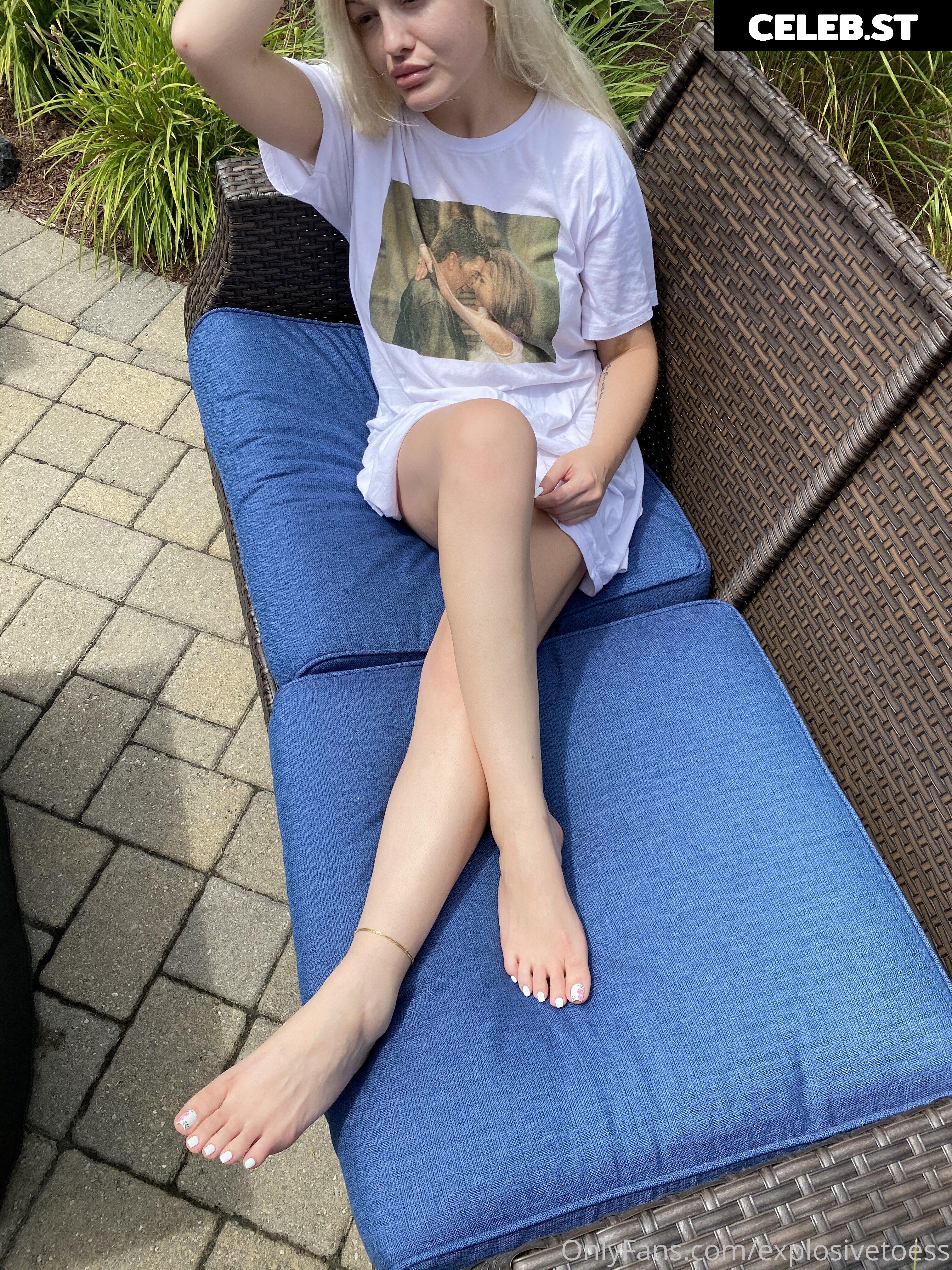 explosivetoess Image 17762846