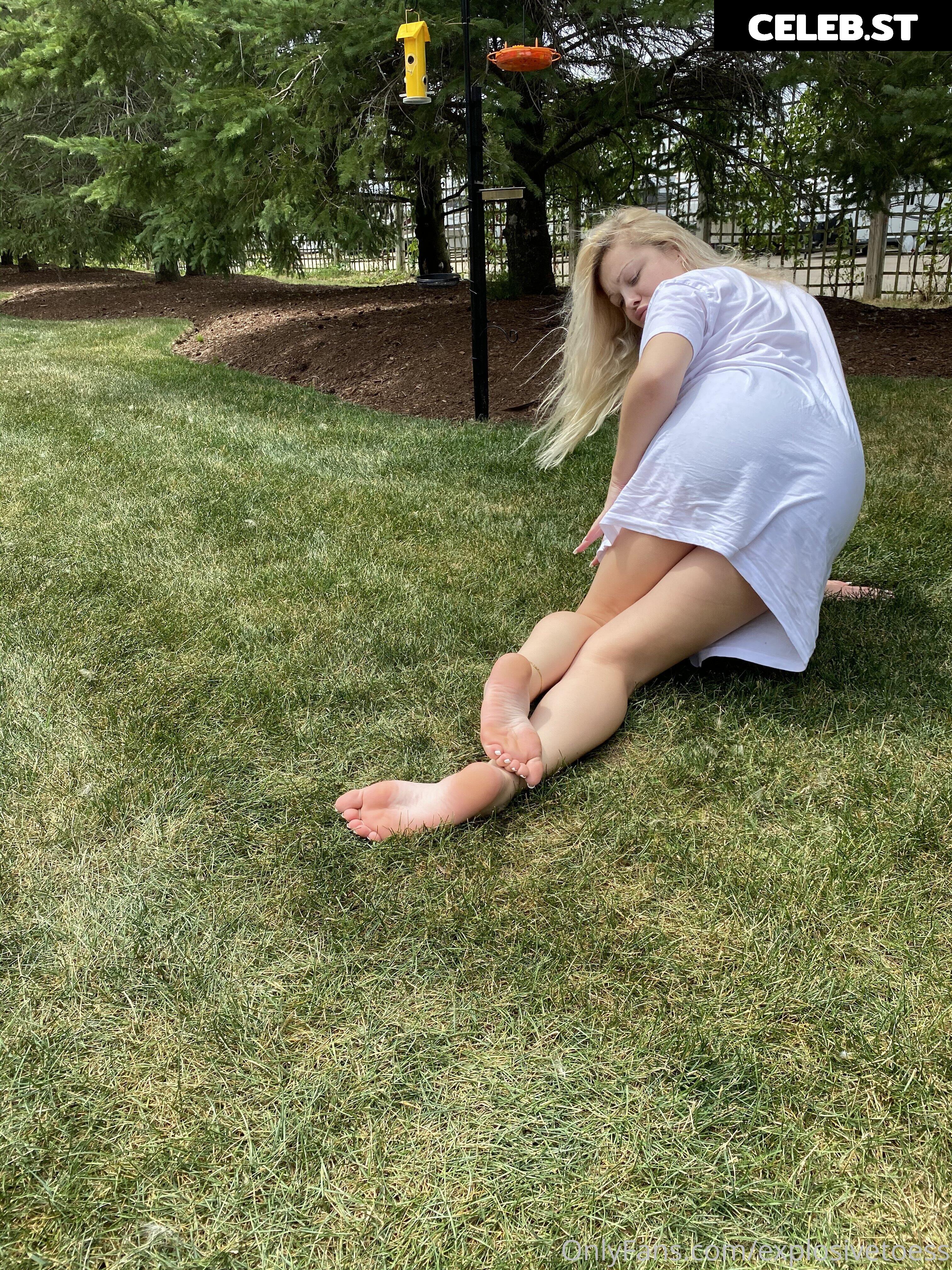 explosivetoess Image 17762593