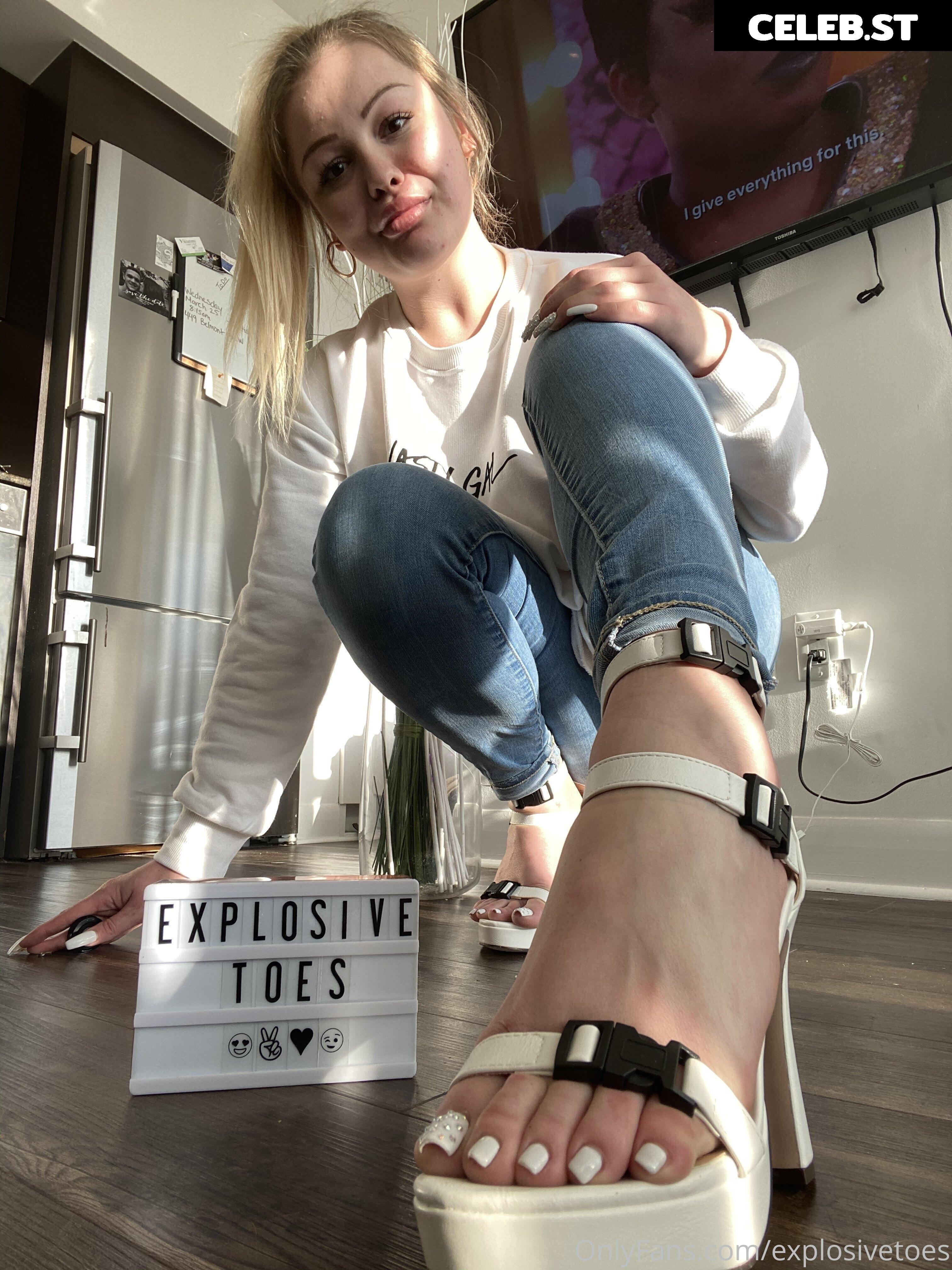 explosivetoess Image 17769836