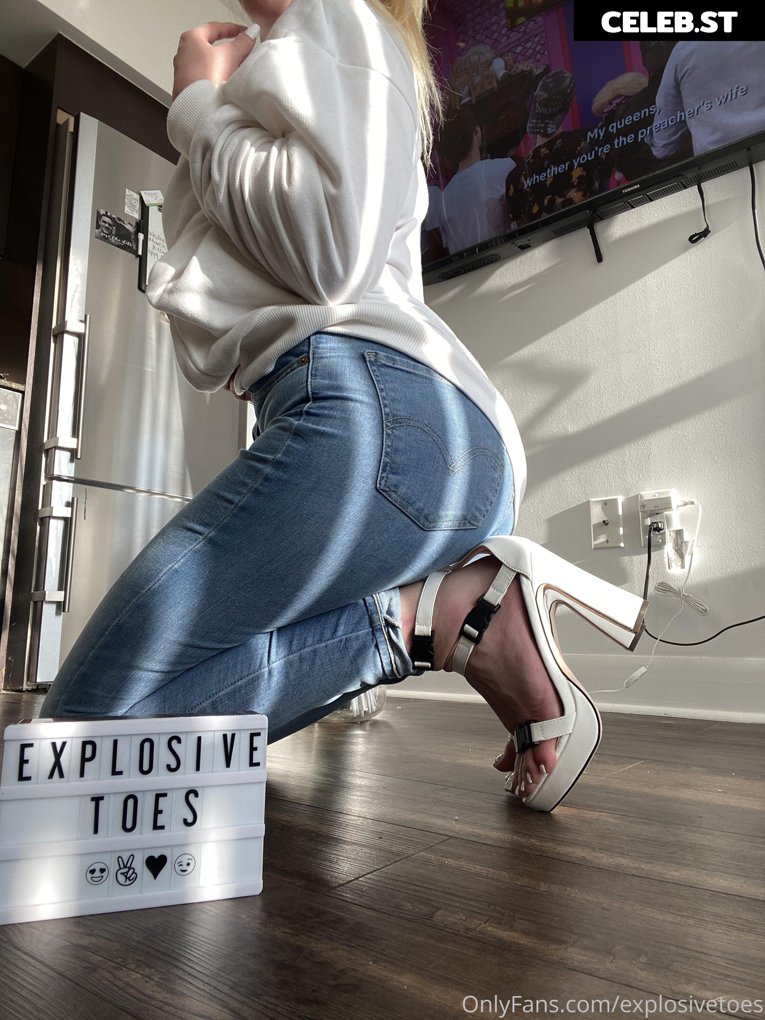 explosivetoess Image 17769834