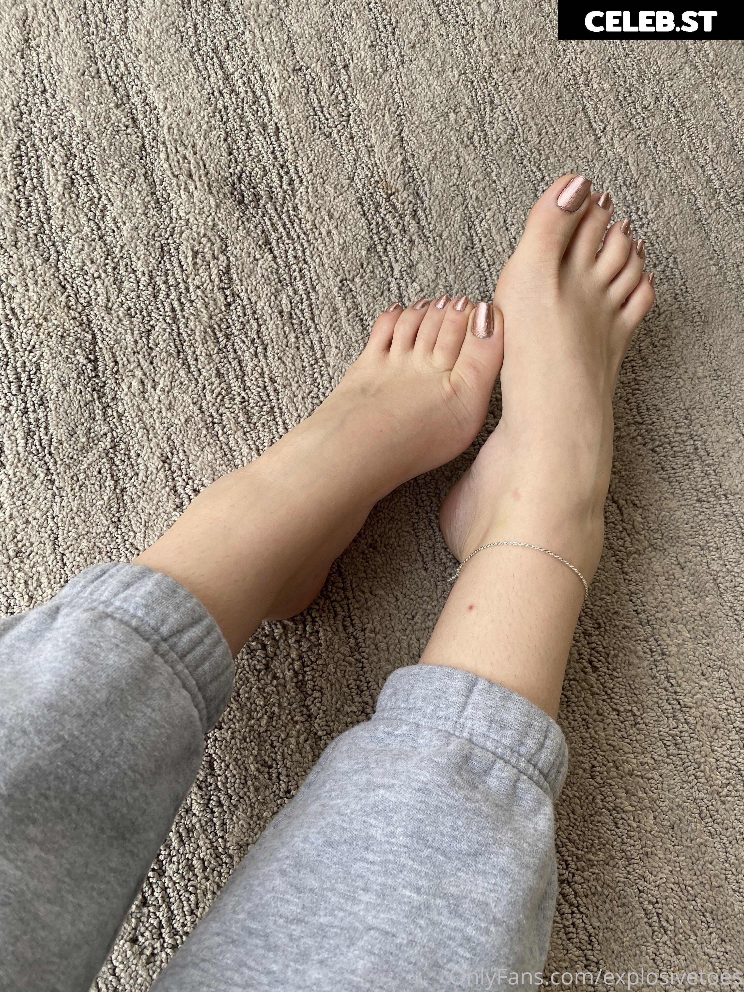 explosivetoess Image 17769481