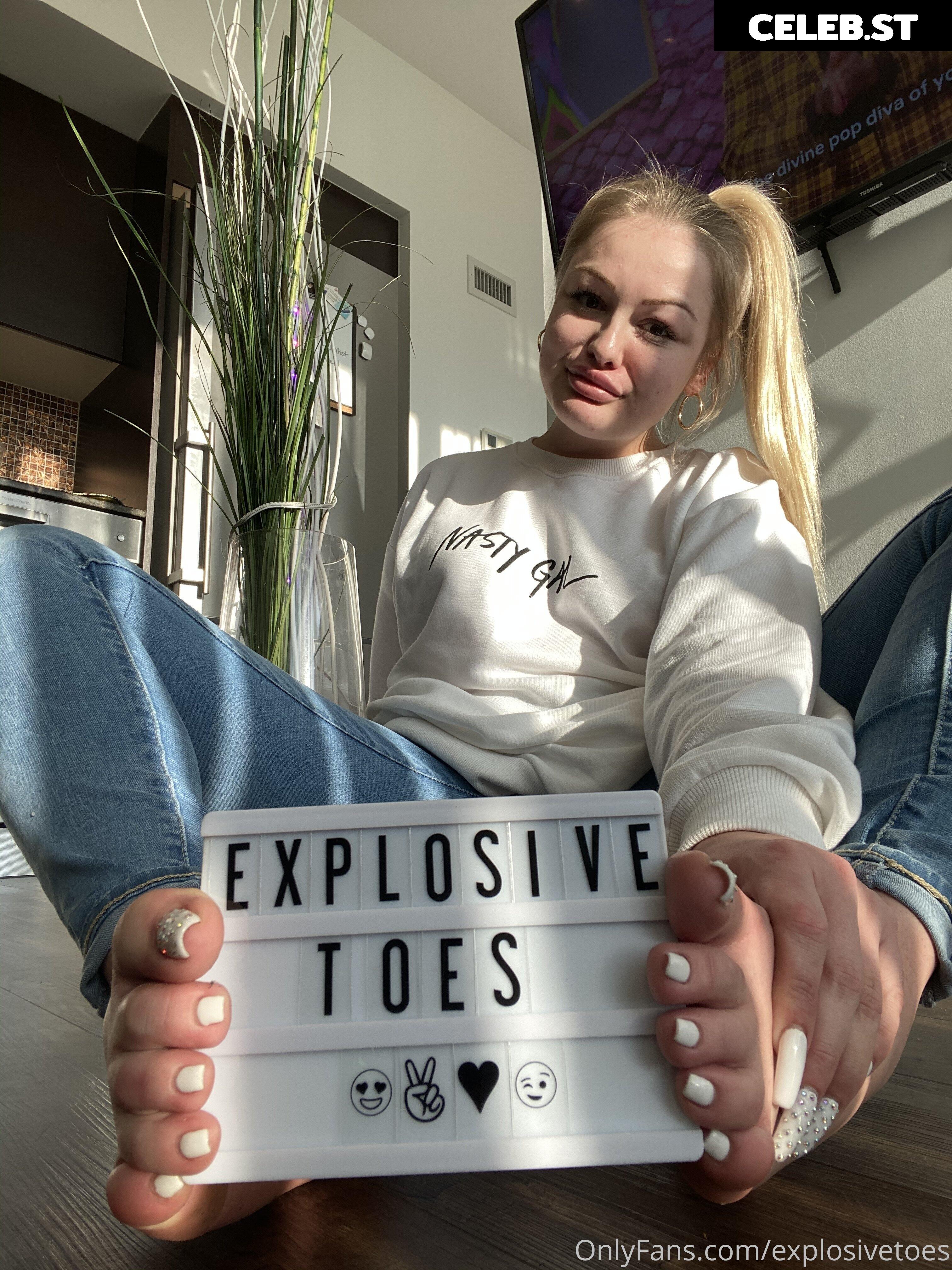 explosivetoess Image 17769487