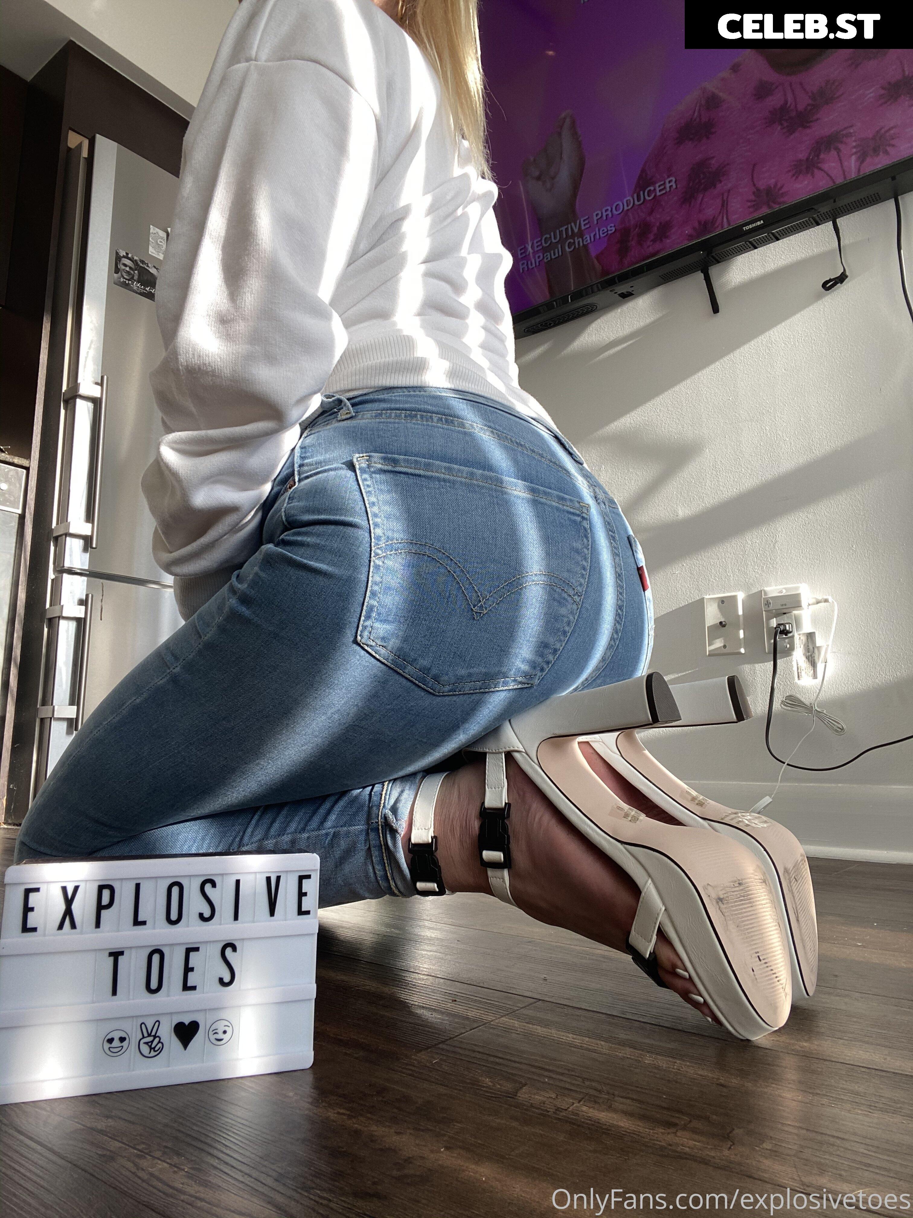 explosivetoess Image 17769489