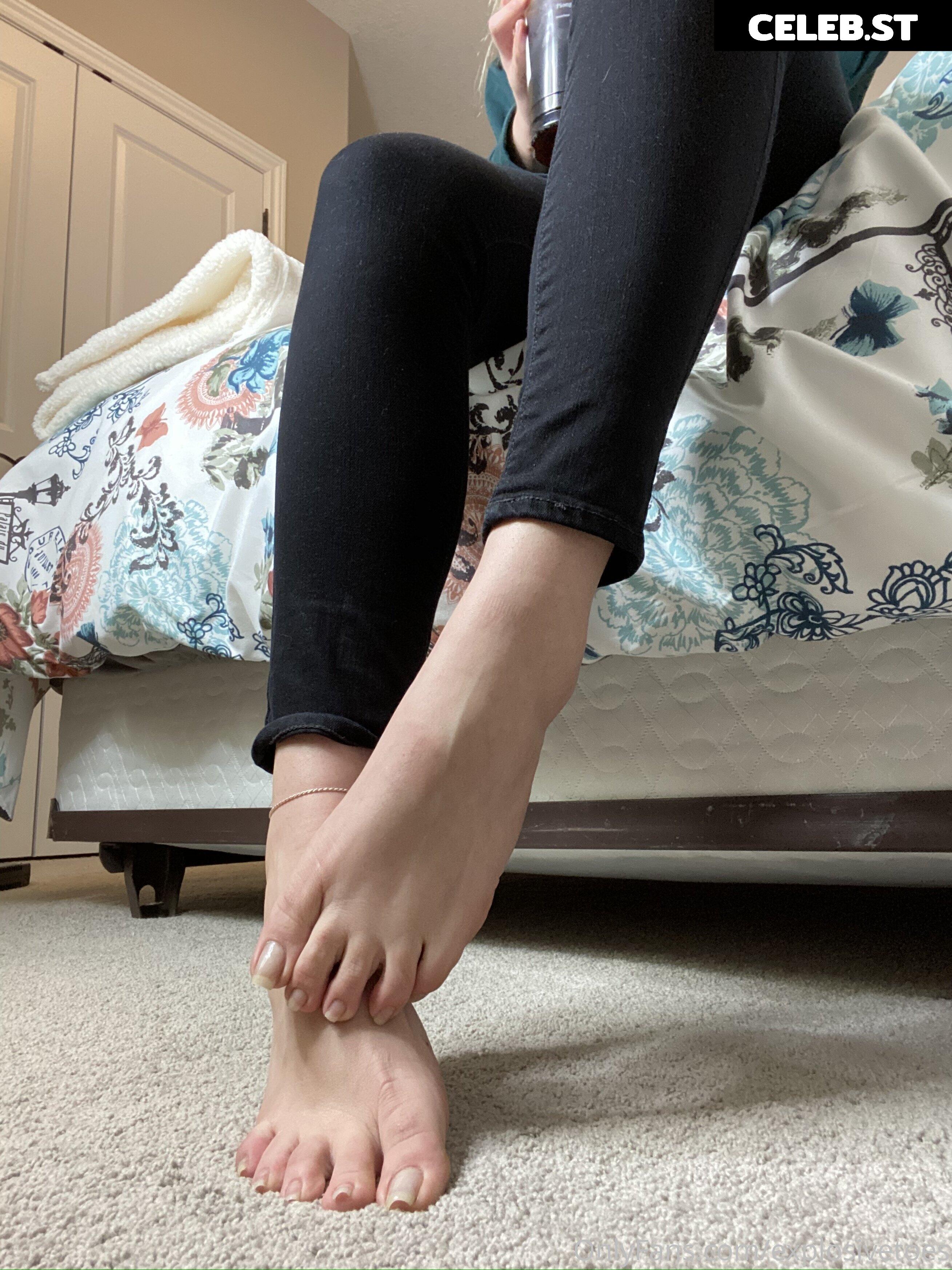 explosivetoess Image 17769453