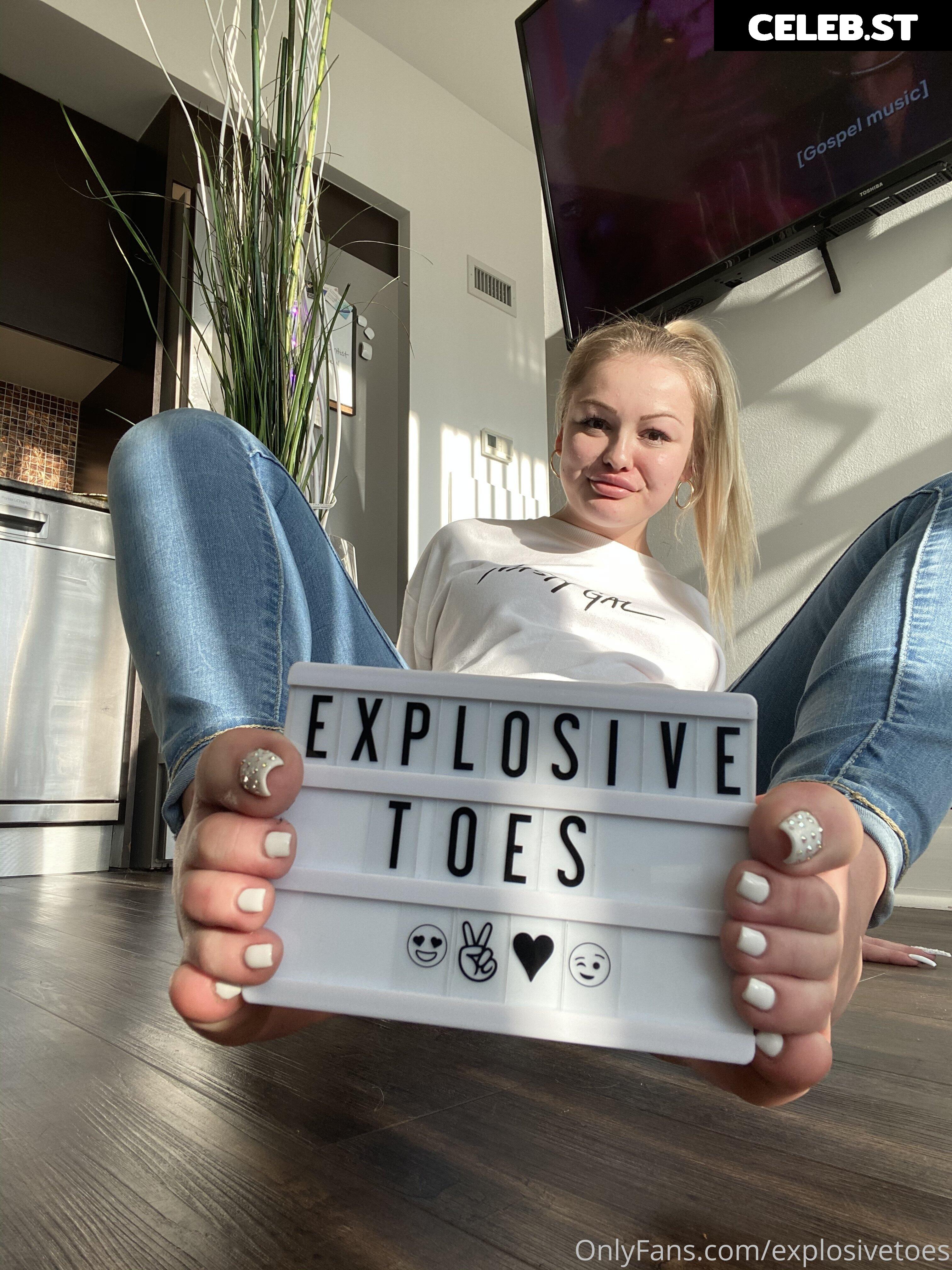 explosivetoess Image 17769451