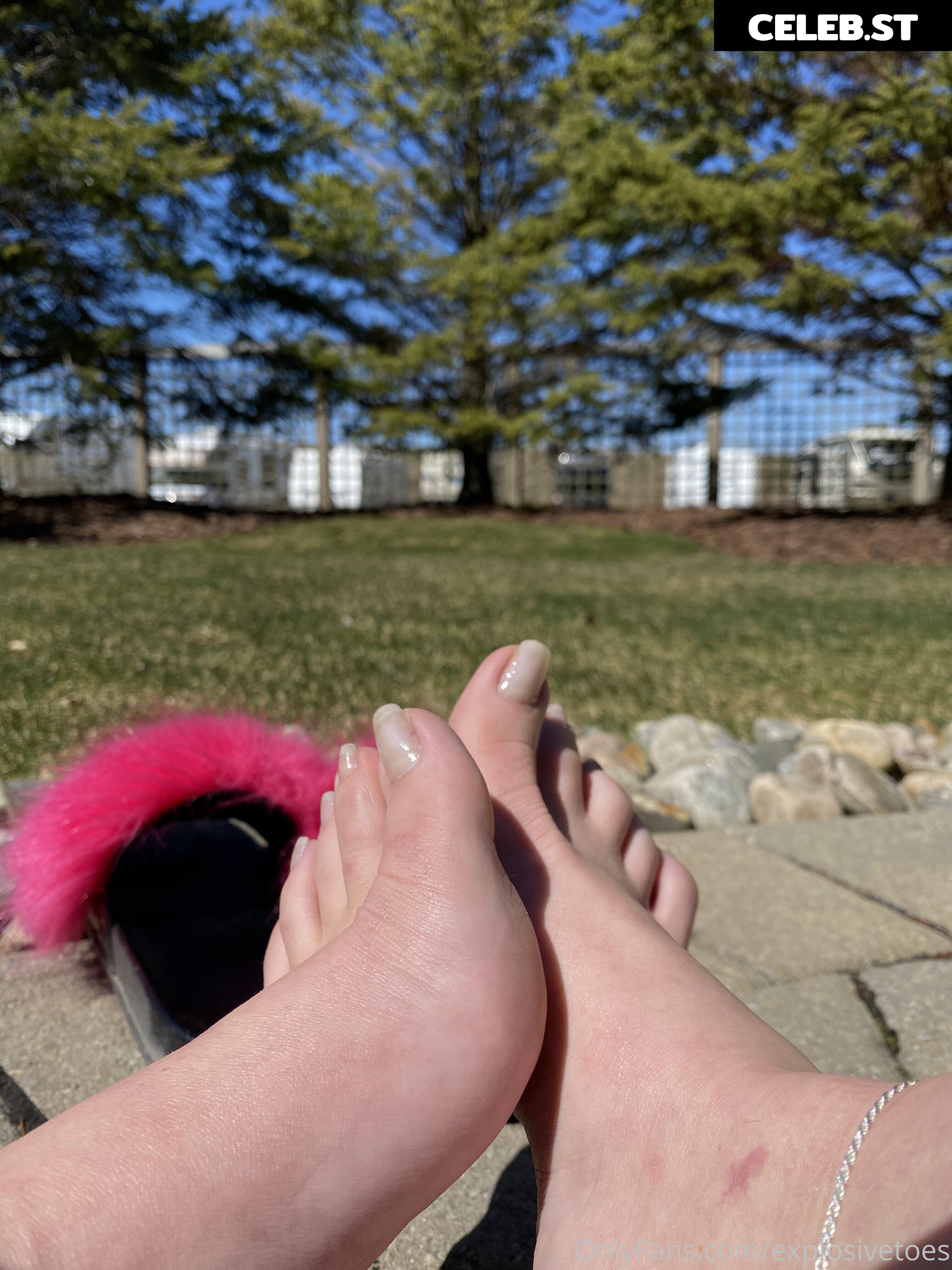 explosivetoess Image 17769617