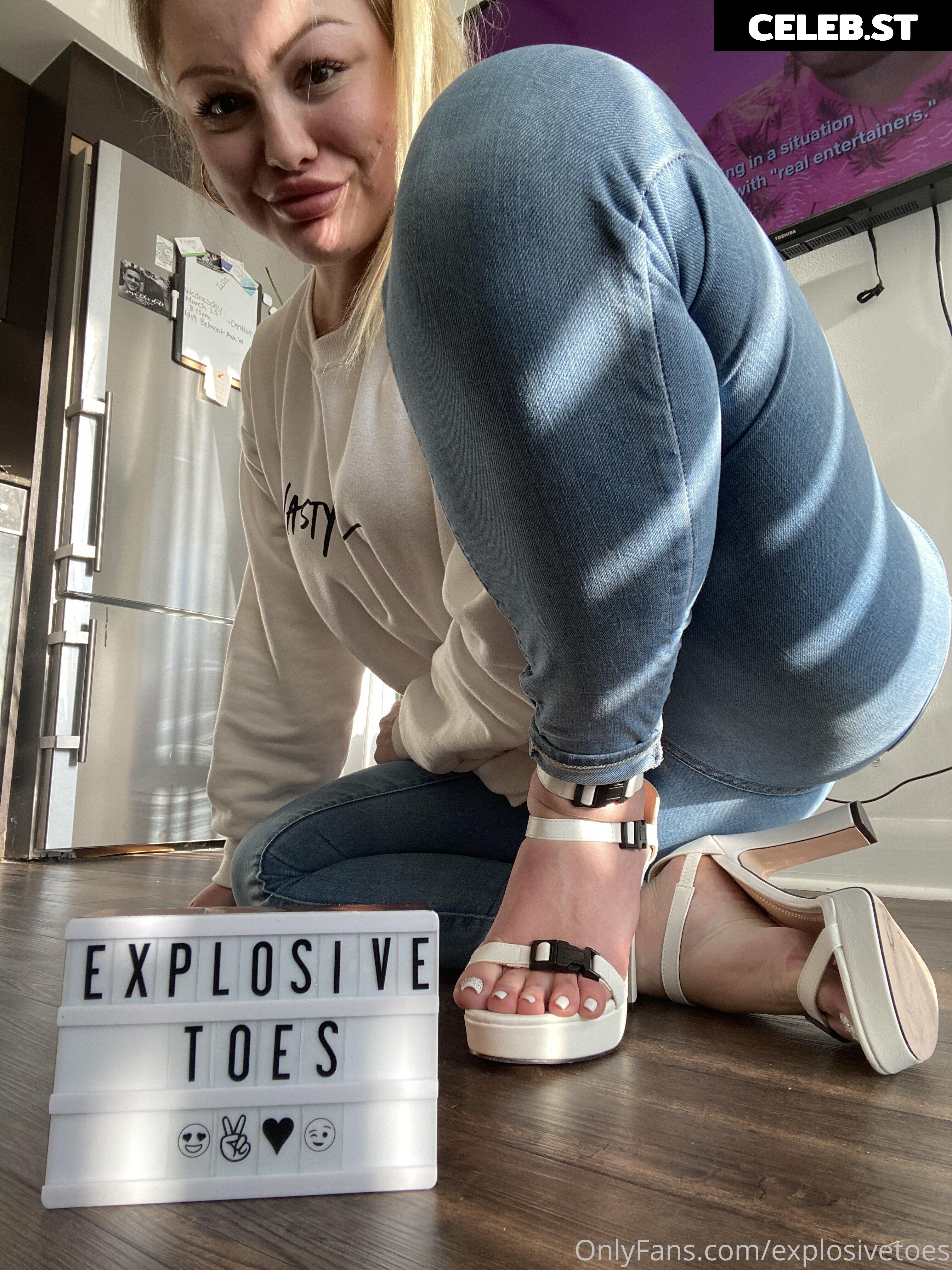 explosivetoess Image 17769646