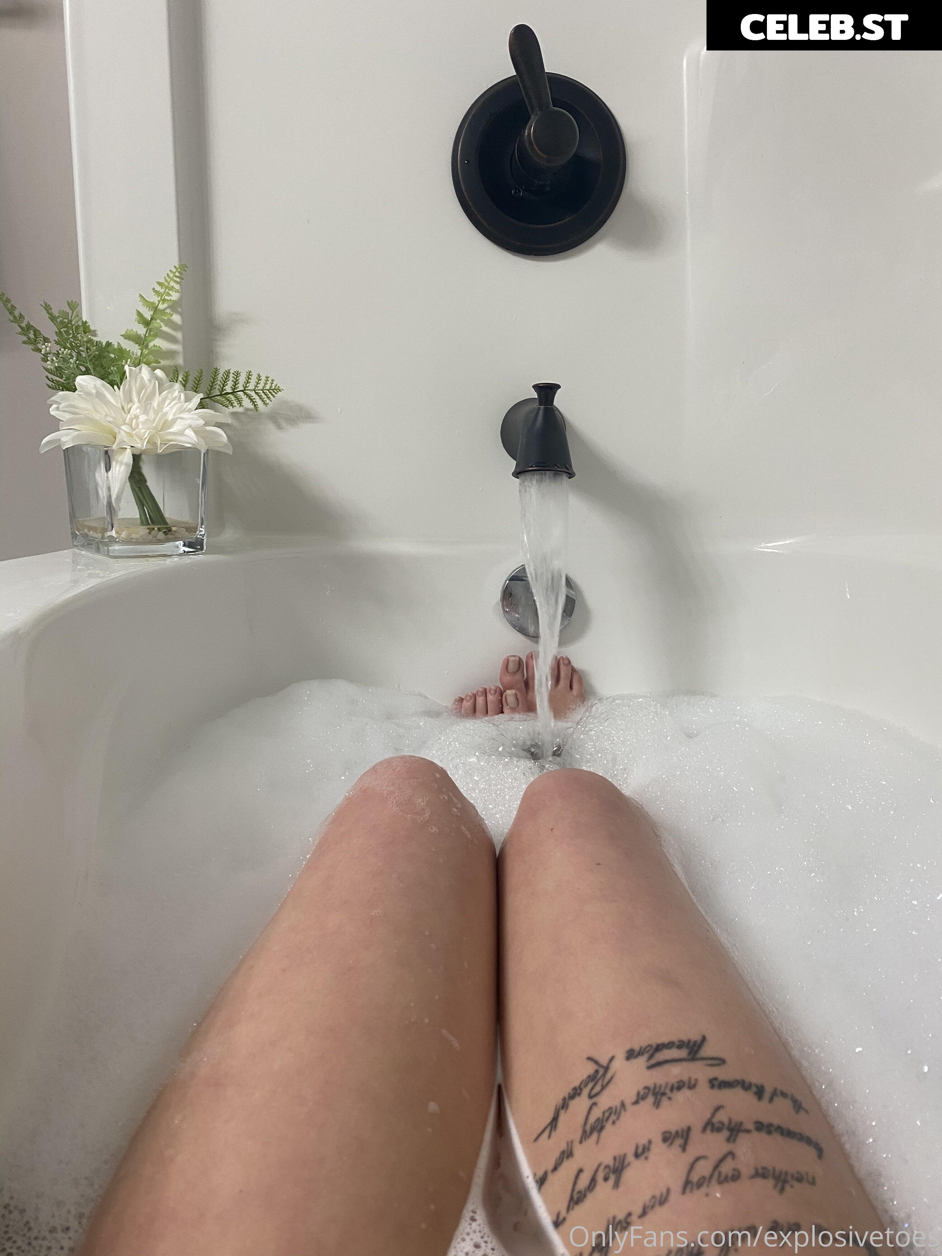 explosivetoess Image 17769314