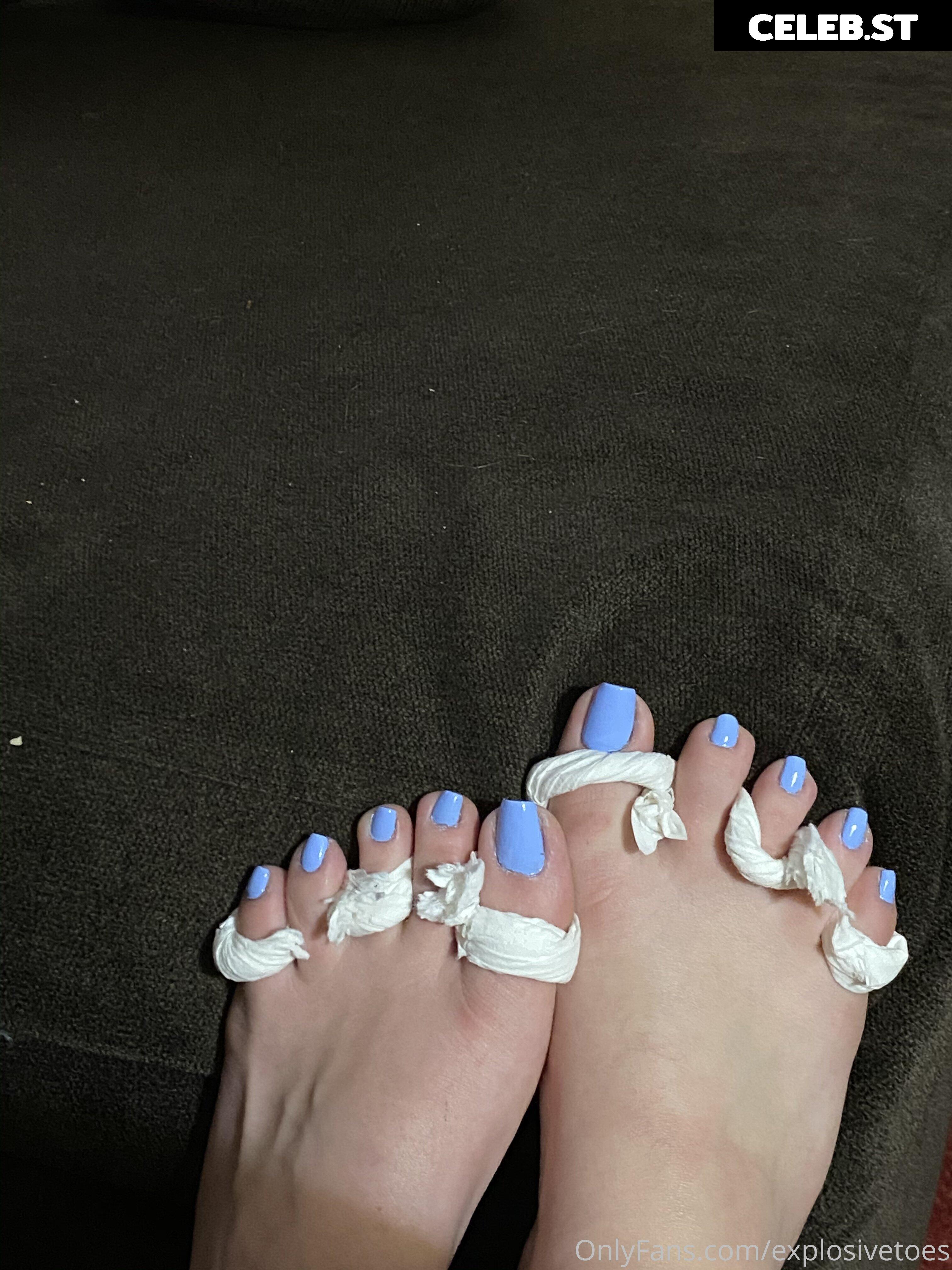 explosivetoess Image 17769292