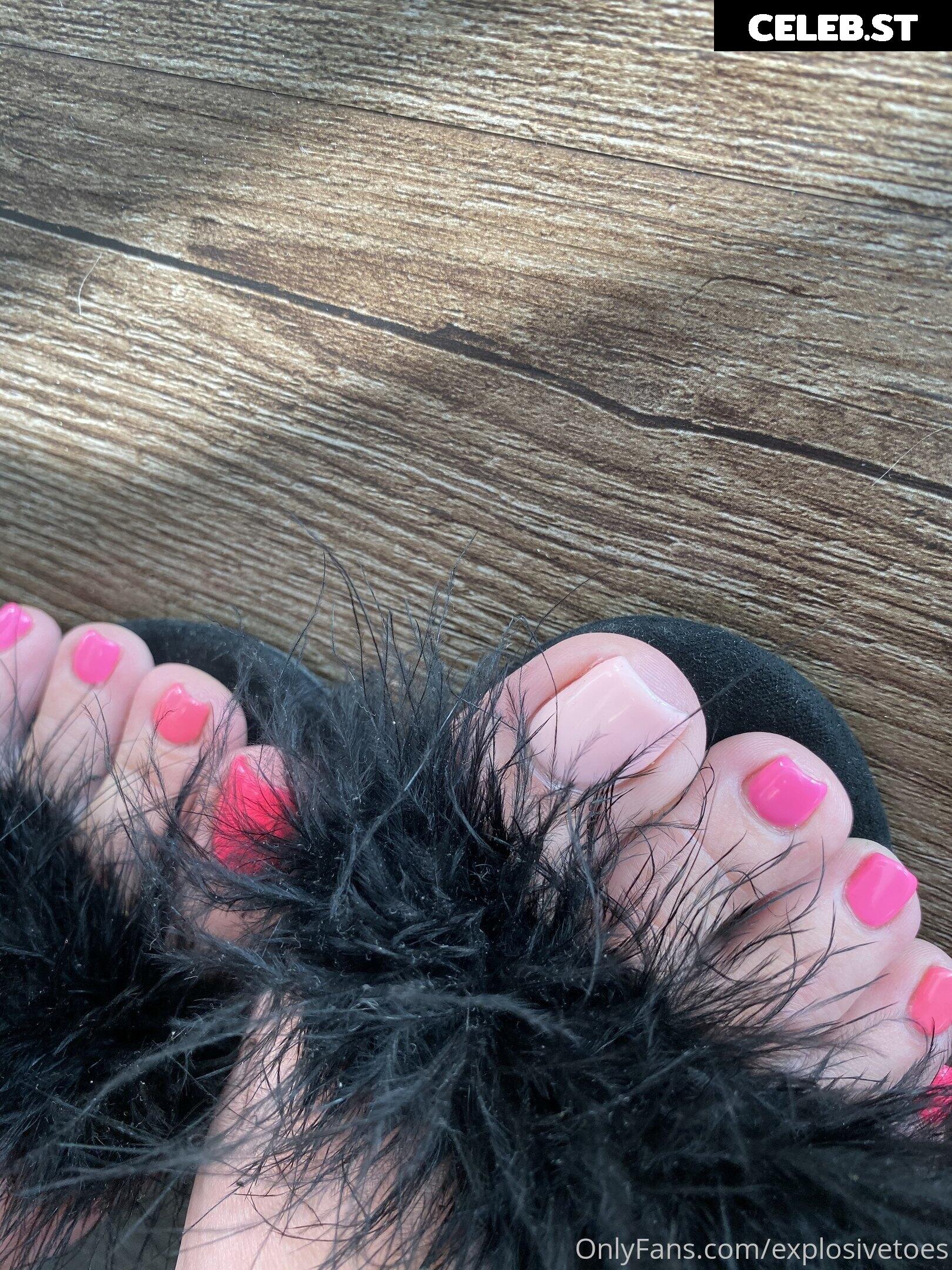 explosivetoess Image 17778045