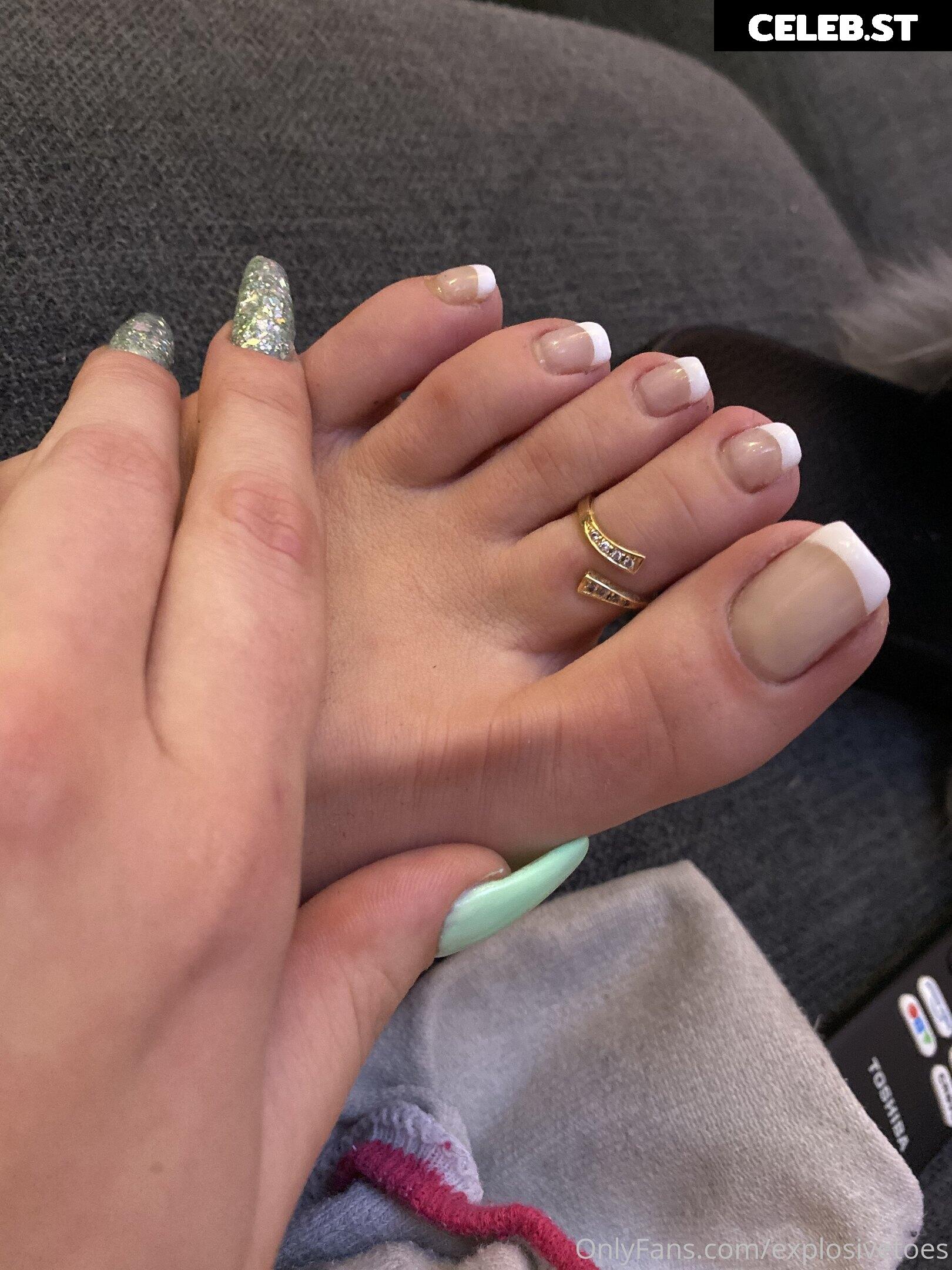 explosivetoess Image 17775464