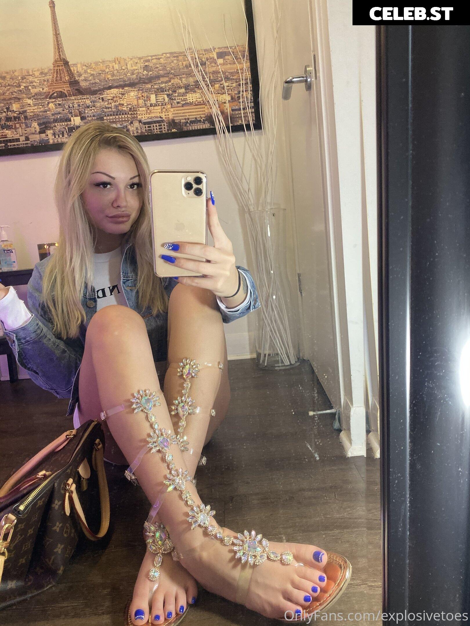 explosivetoess Image 17775448