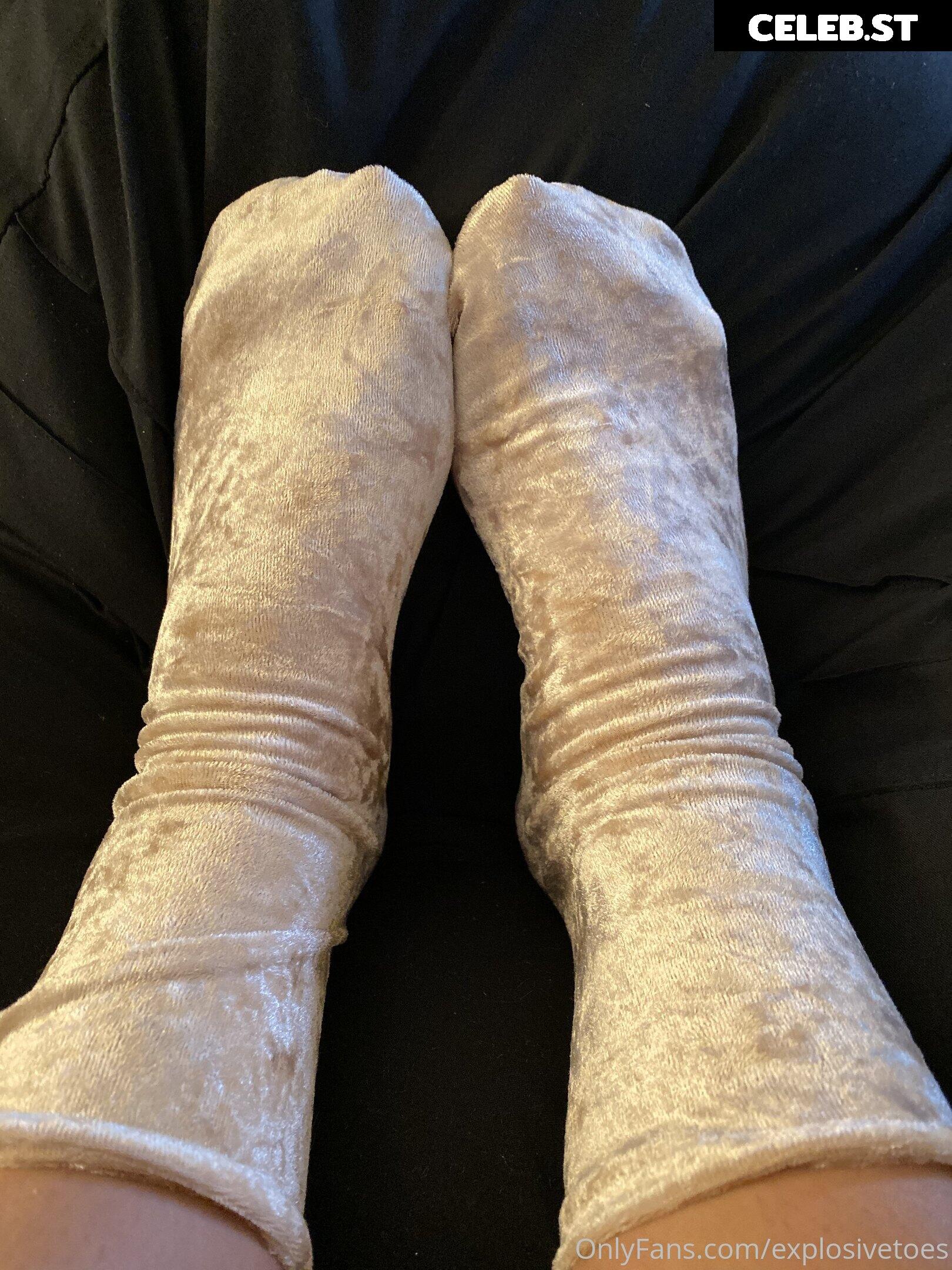 explosivetoess Image 17775622