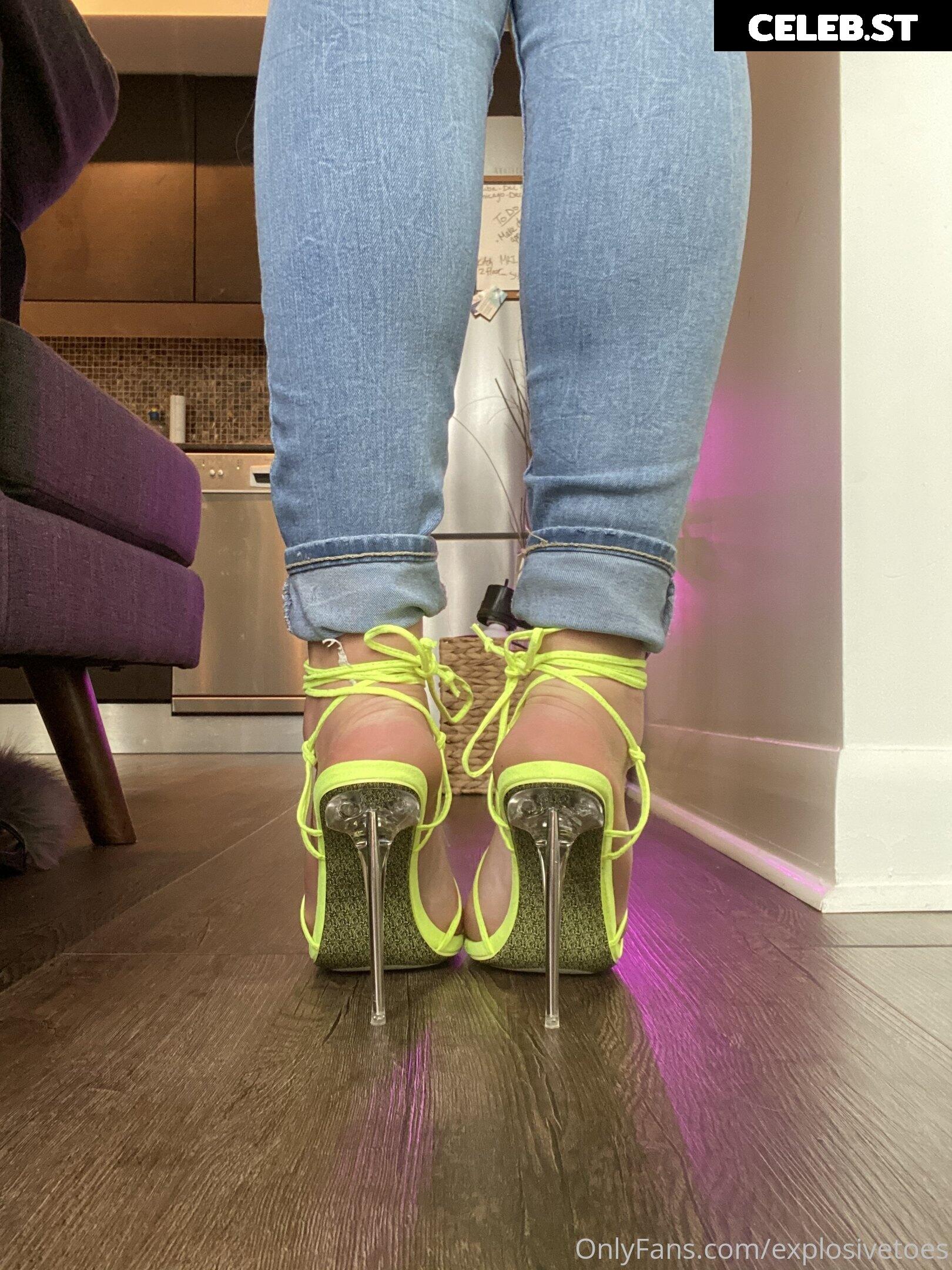 explosivetoess Image 17775628