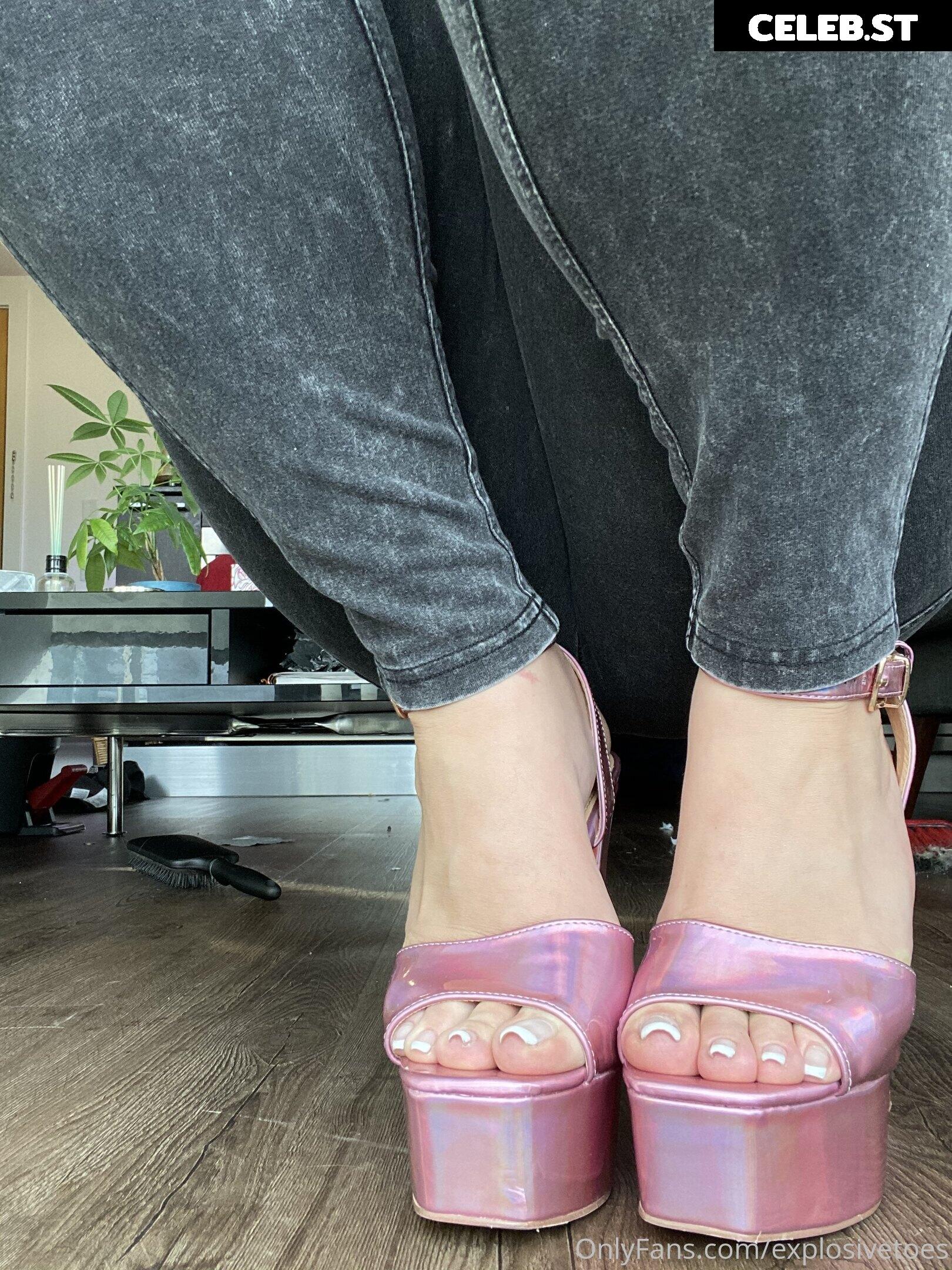 explosivetoess Image 17775325