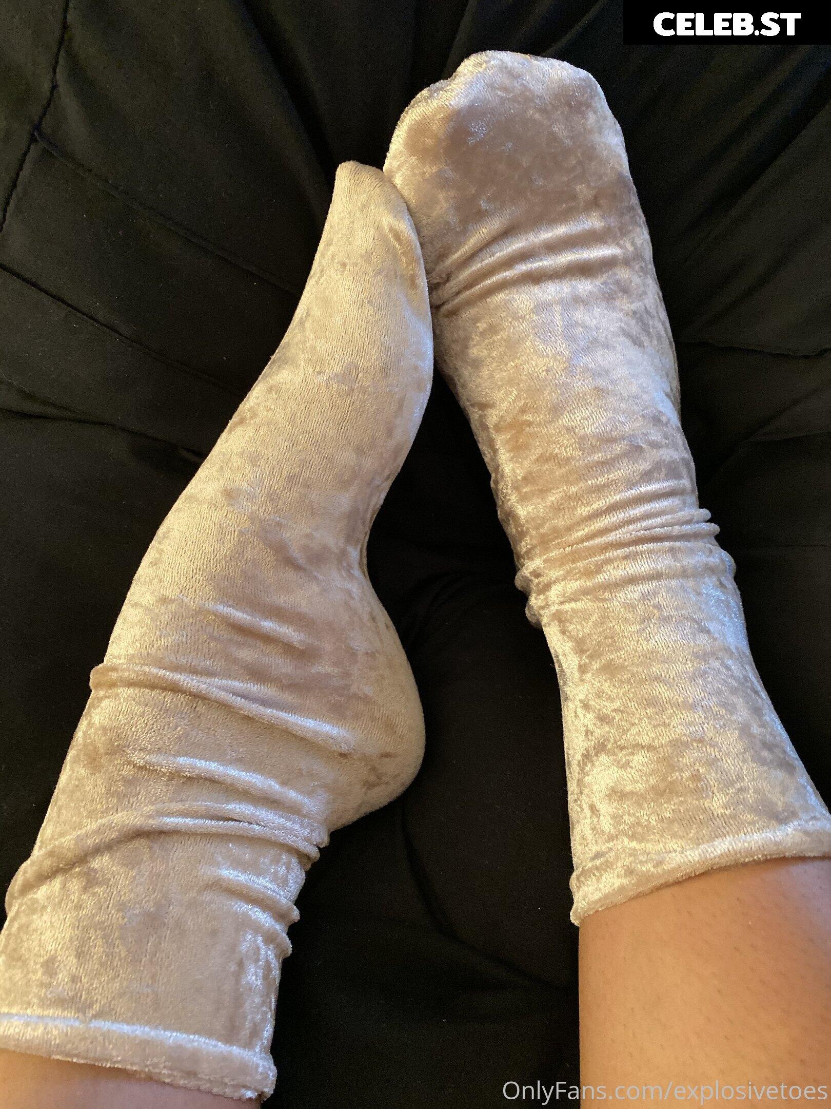 explosivetoess Image 17775310