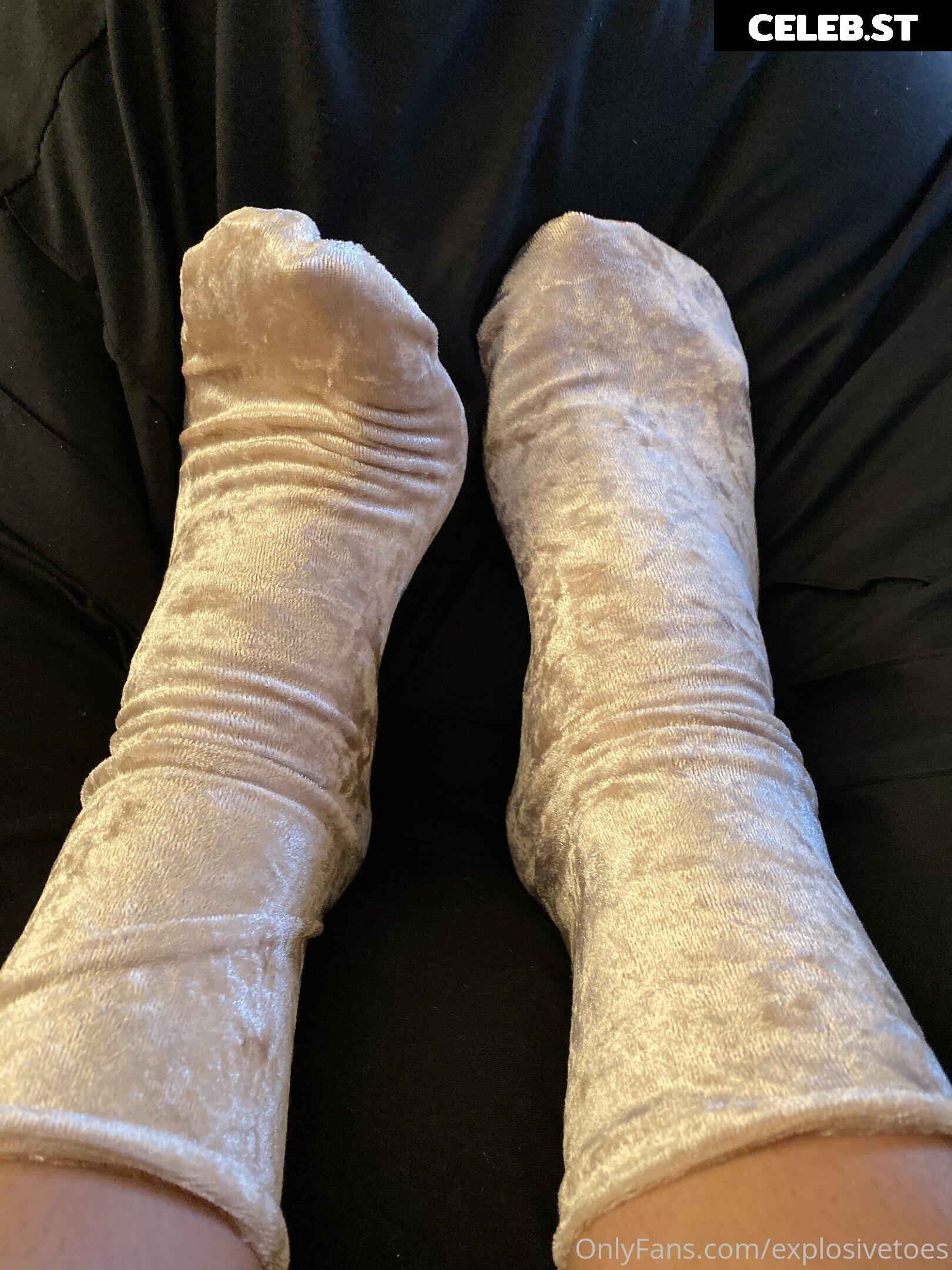 explosivetoess Image 17775278