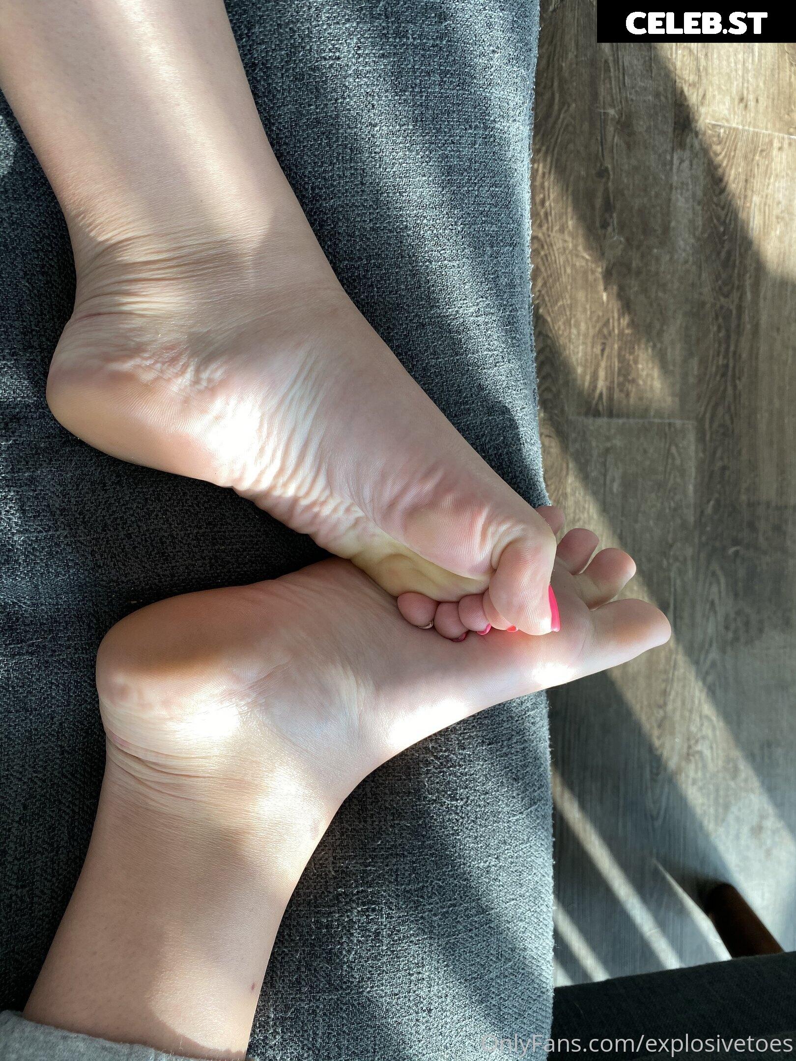 explosivetoess Image 17777910