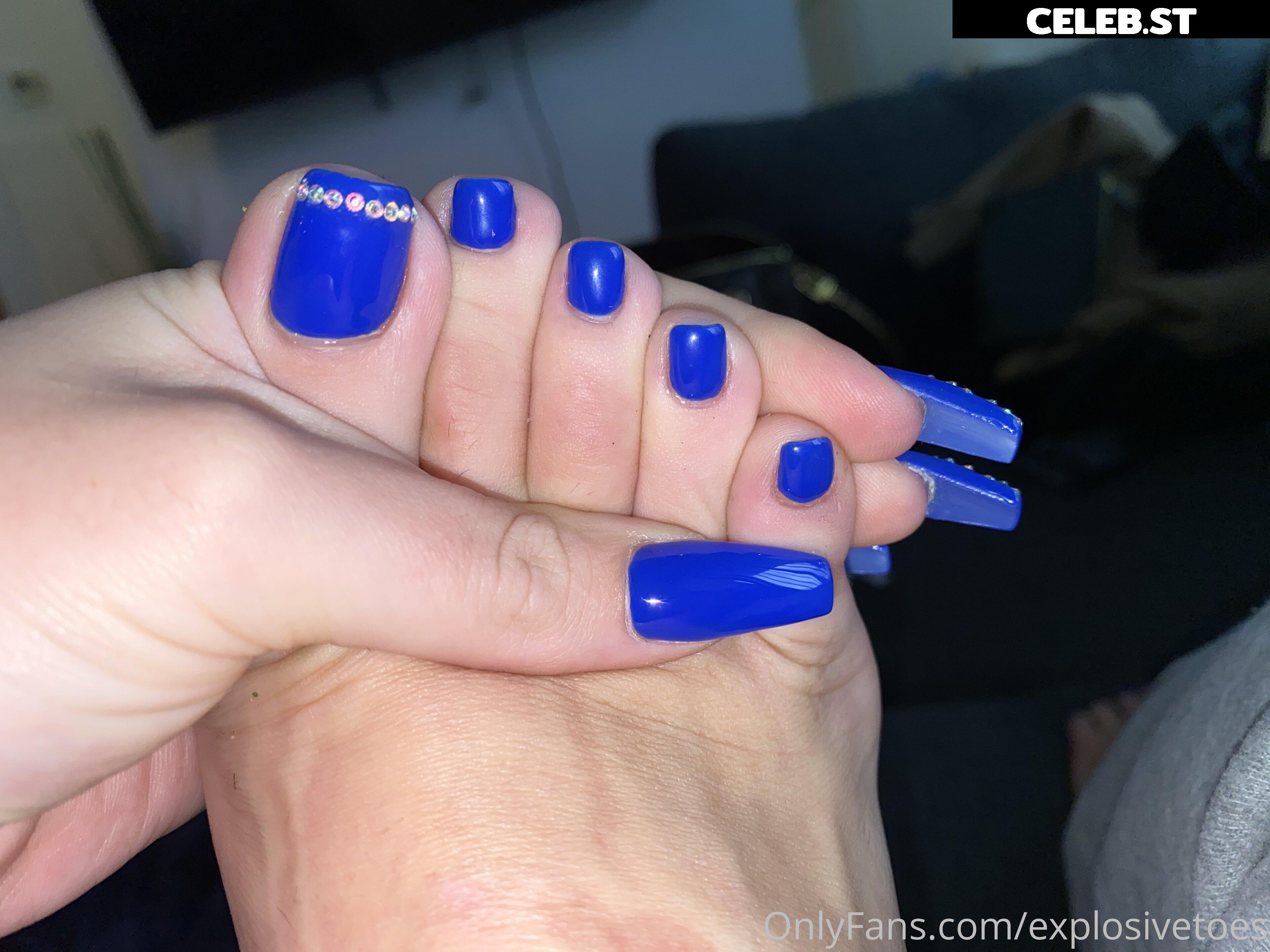 explosivetoess Image 17777059