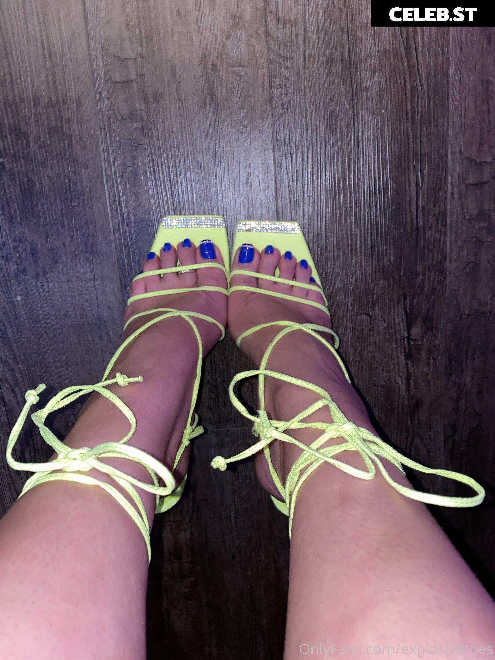 explosivetoess Image 17776871