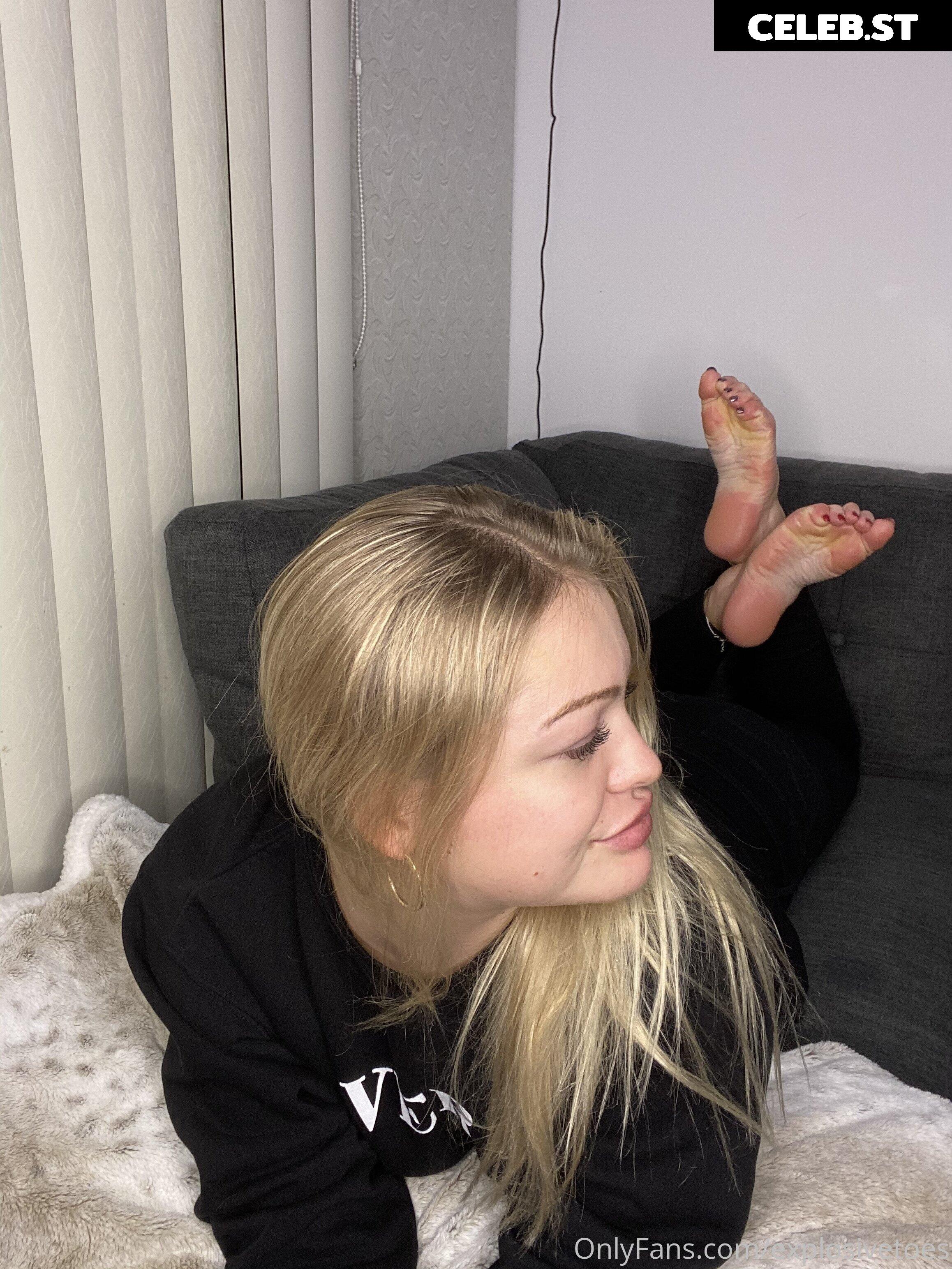 explosivetoess Image 17770812
