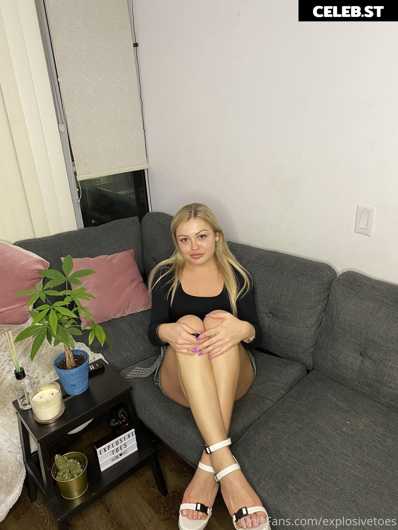 explosivetoess Image 17770816