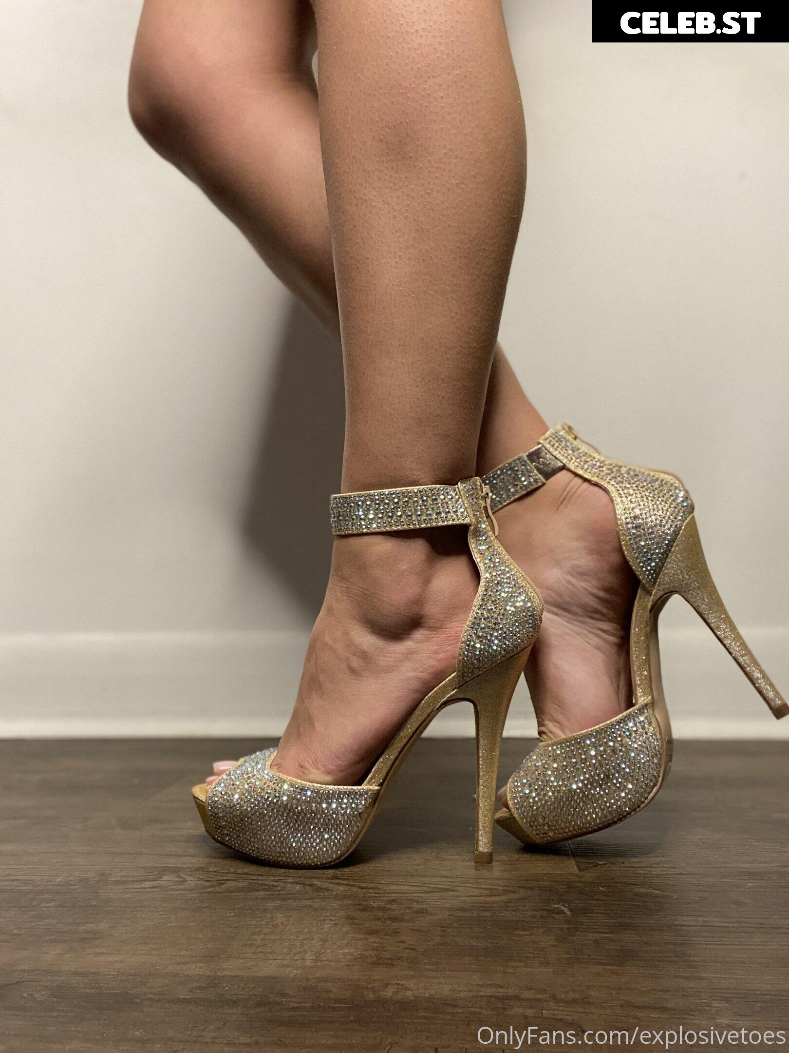 explosivetoess Image 17770848