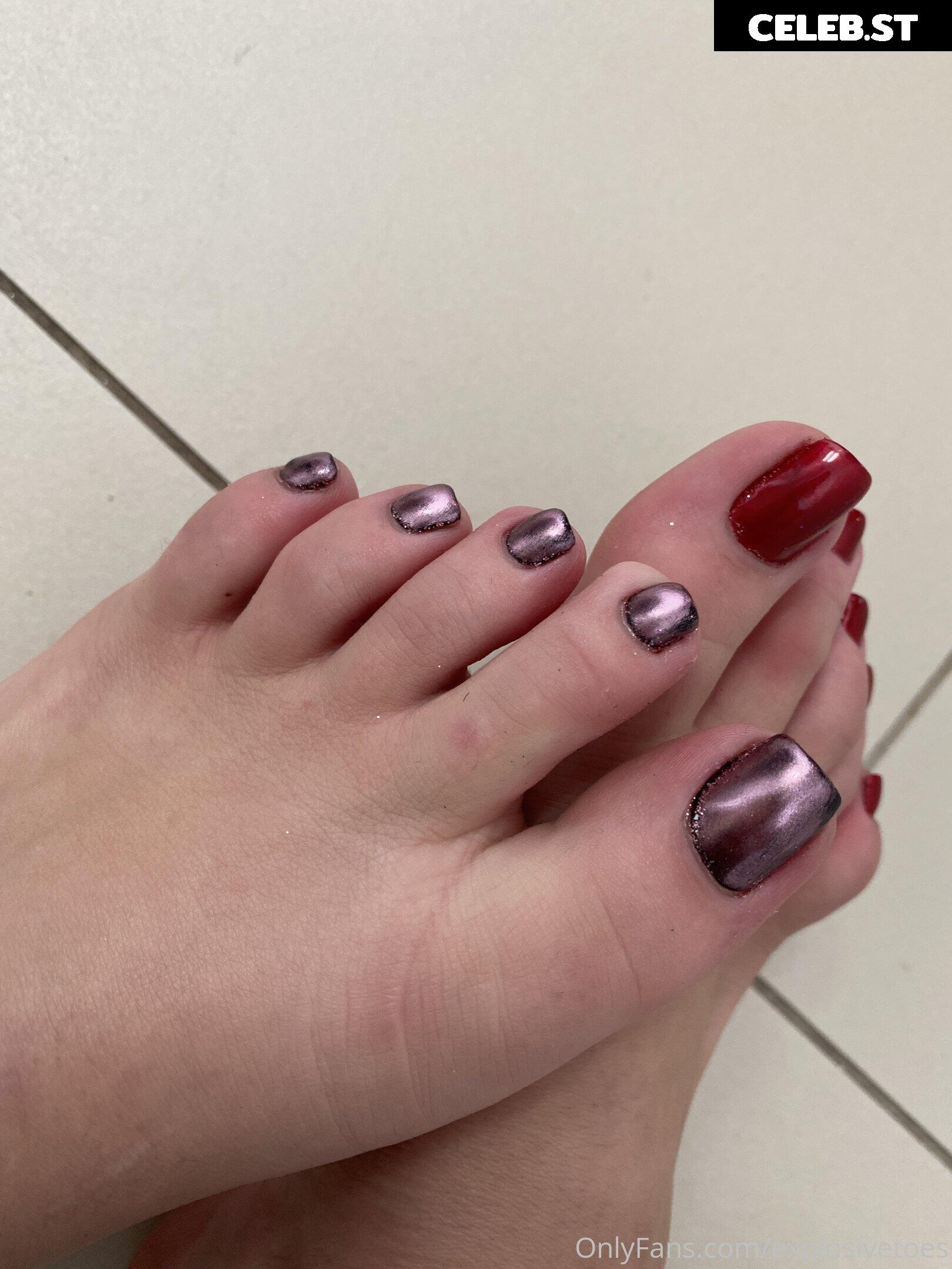 explosivetoess Image 17770699