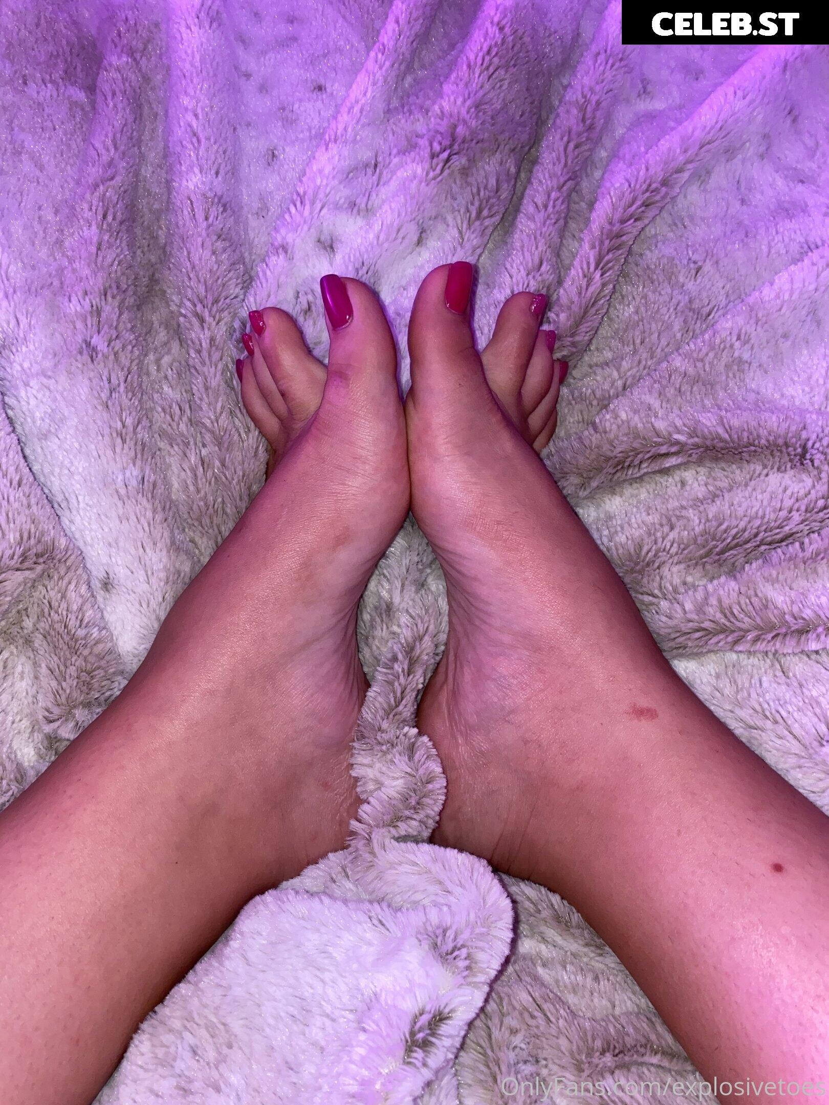 explosivetoess Image 17773131