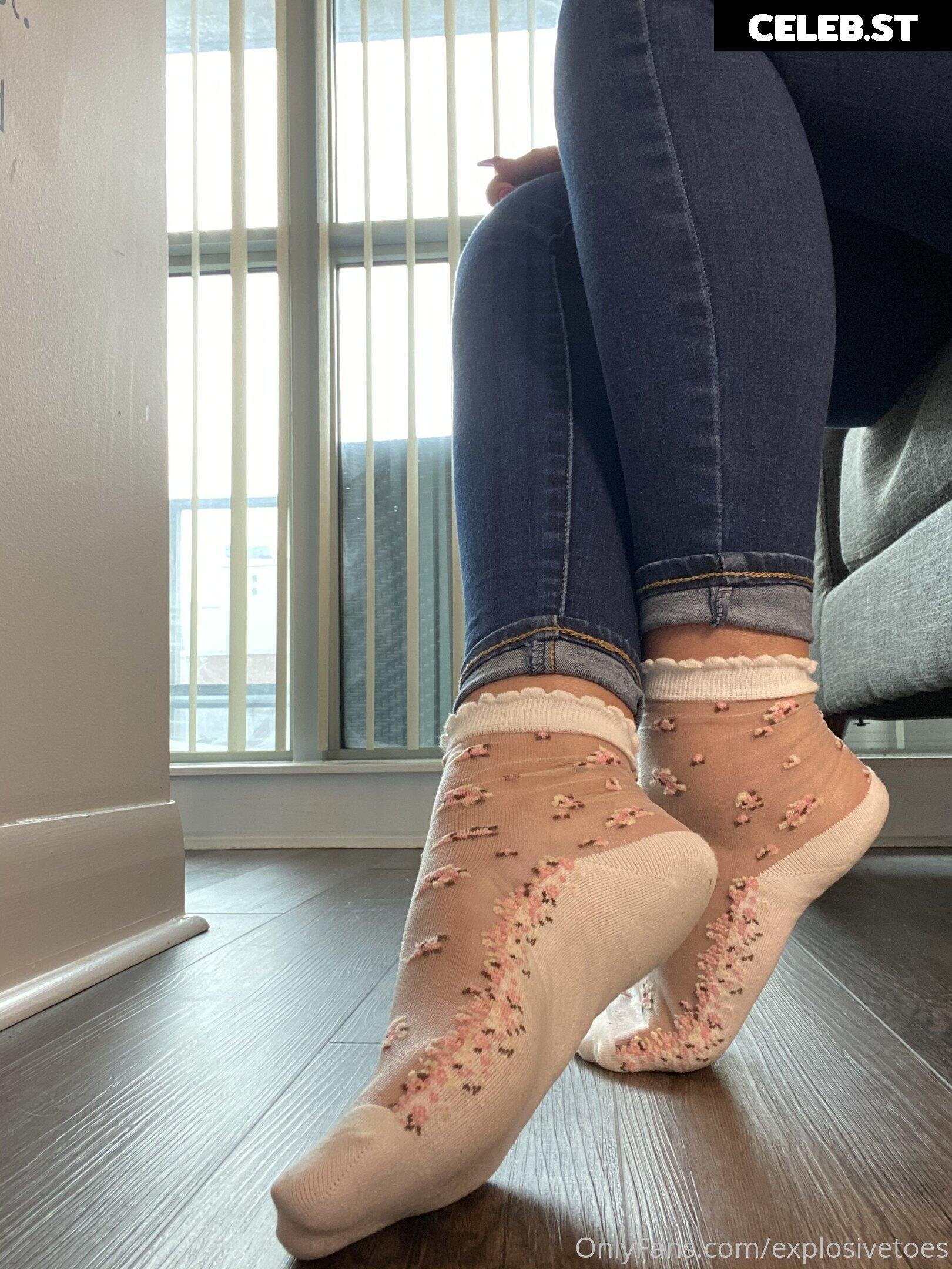 explosivetoess Image 17773141